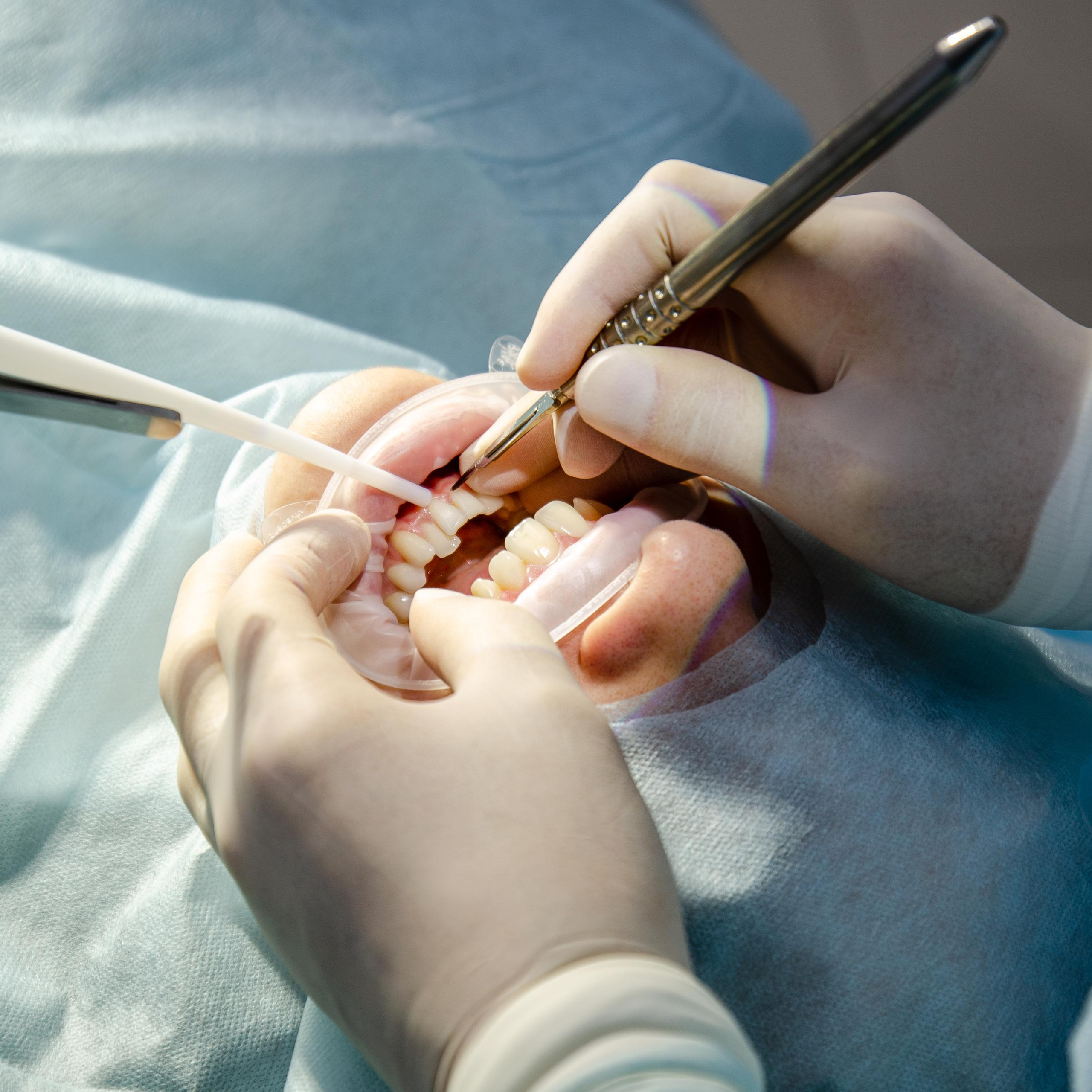 Стоматология. Рекламный, предметный и фуд-фотограф в Ставрополе Ворнавской Евгений