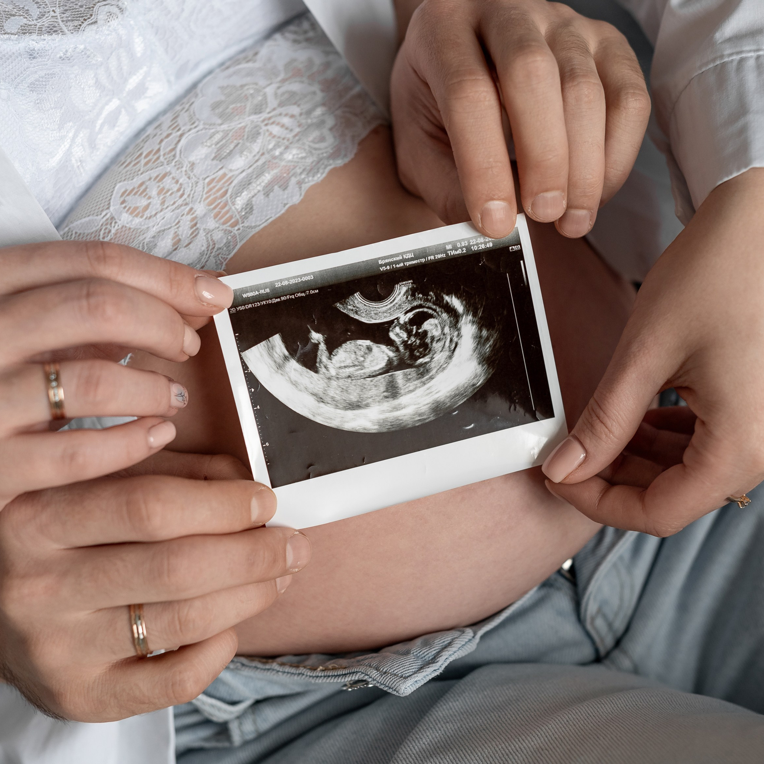 Отзывы. Свадебный, семейный и репортажный фотограф. Брянск. Эльвира Голенкова
