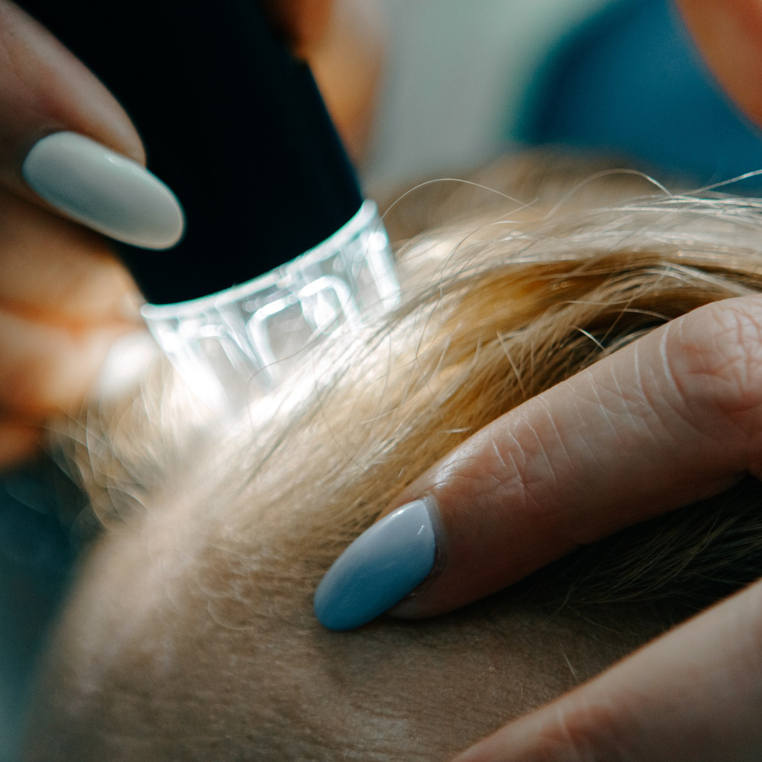 Контент для трихолога. Фотография, которая говорит о тебе