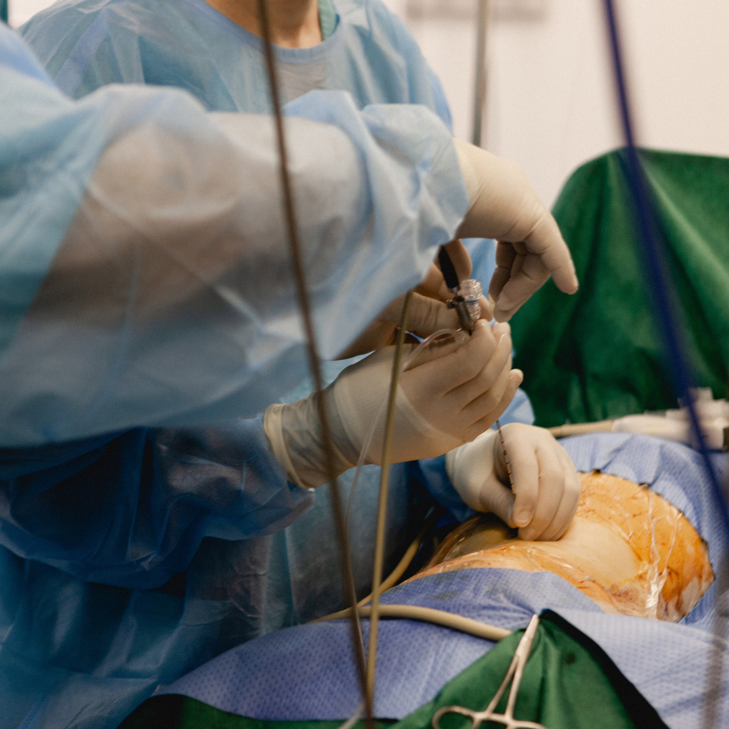 Опер блок урология. Фотография, которая говорит о тебе