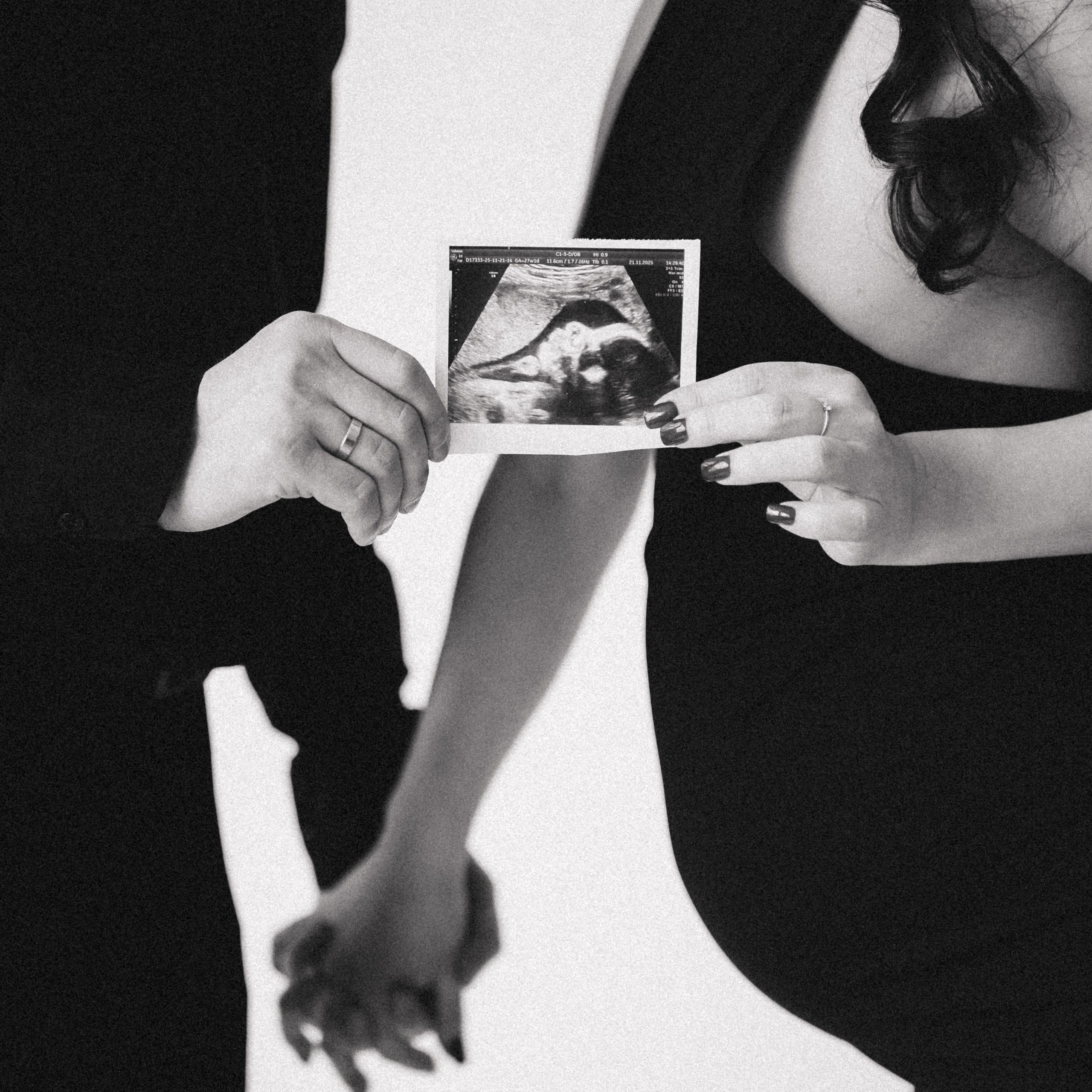 Беременность