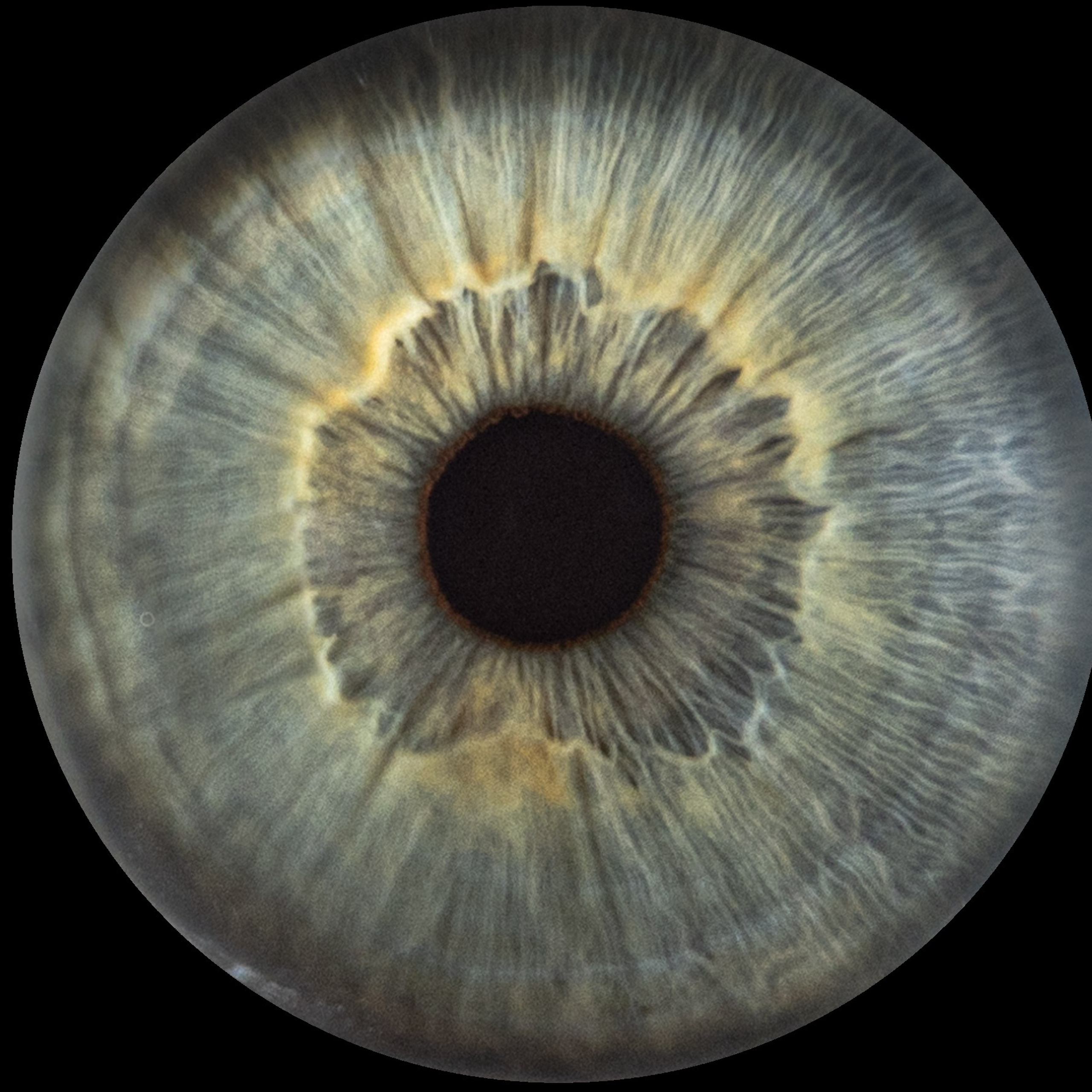 Отзывы. EYEtob | Фотография радужной оболочки | Тобольск