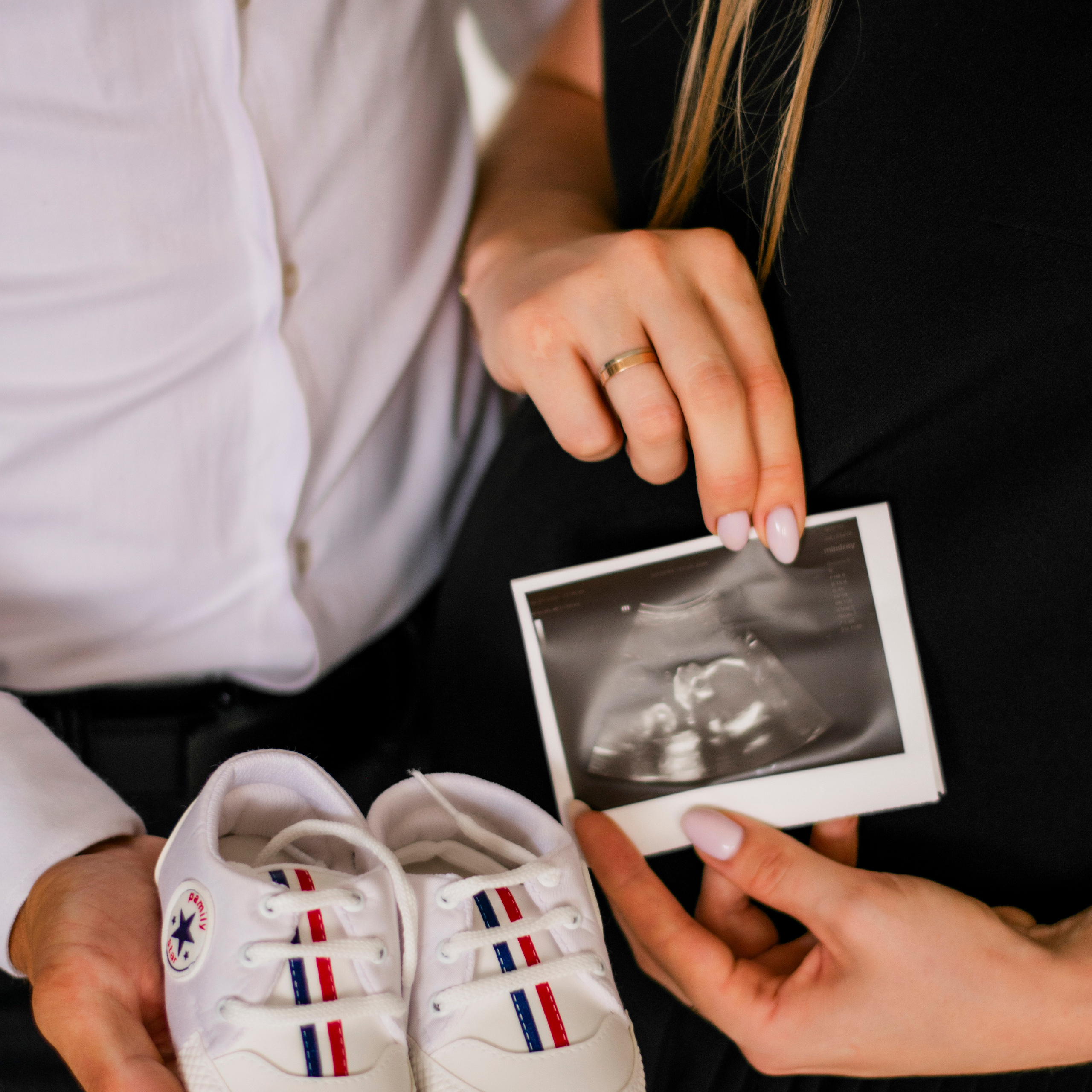 ОЖИДАНИЕ ЧУДА