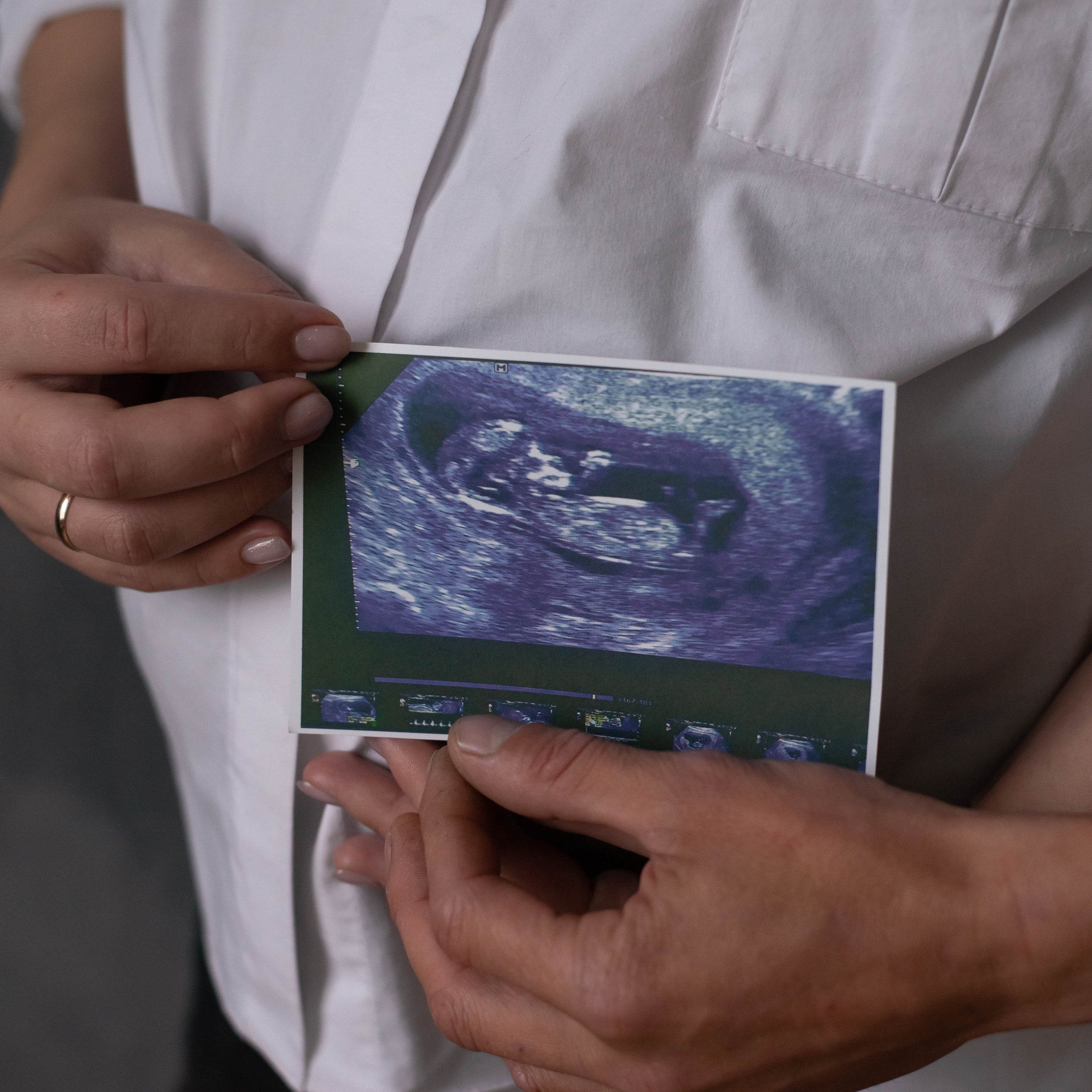 Отзывы. Фотограф новорожденных. Йошкар-Ола