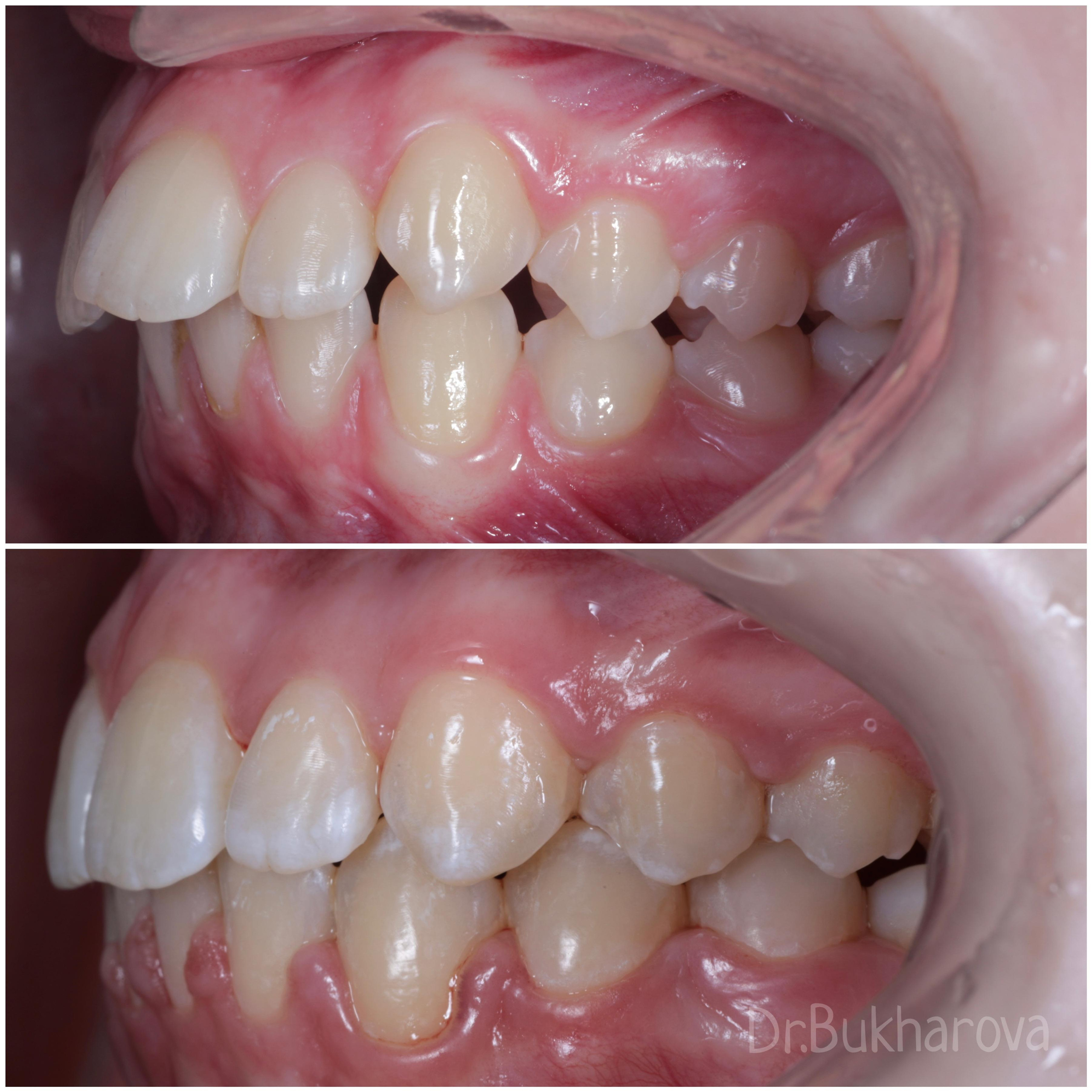 Ортодонтия. Стоматология в Твери - Линия Улыбки