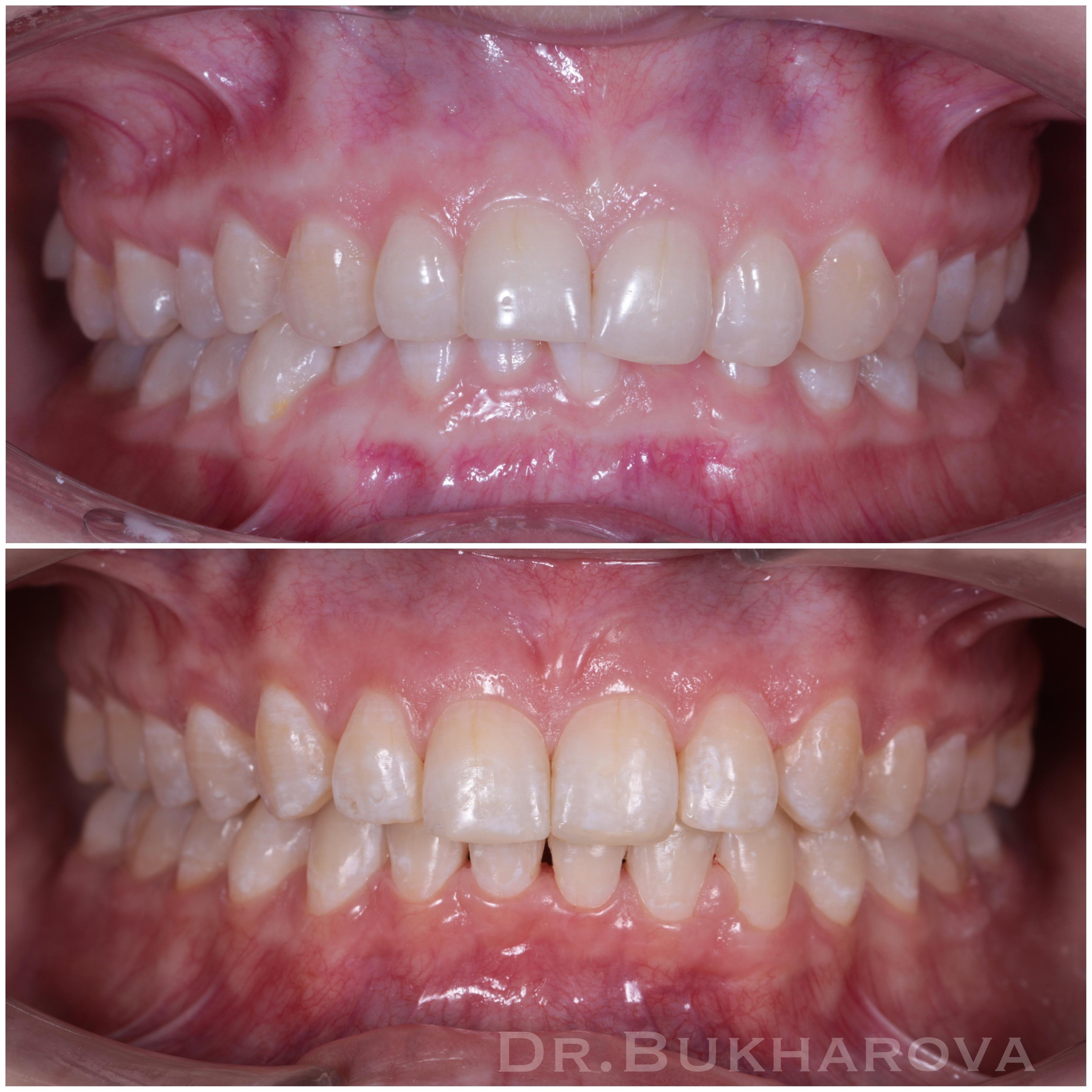 Ортодонтия. Стоматология в Твери - Линия Улыбки