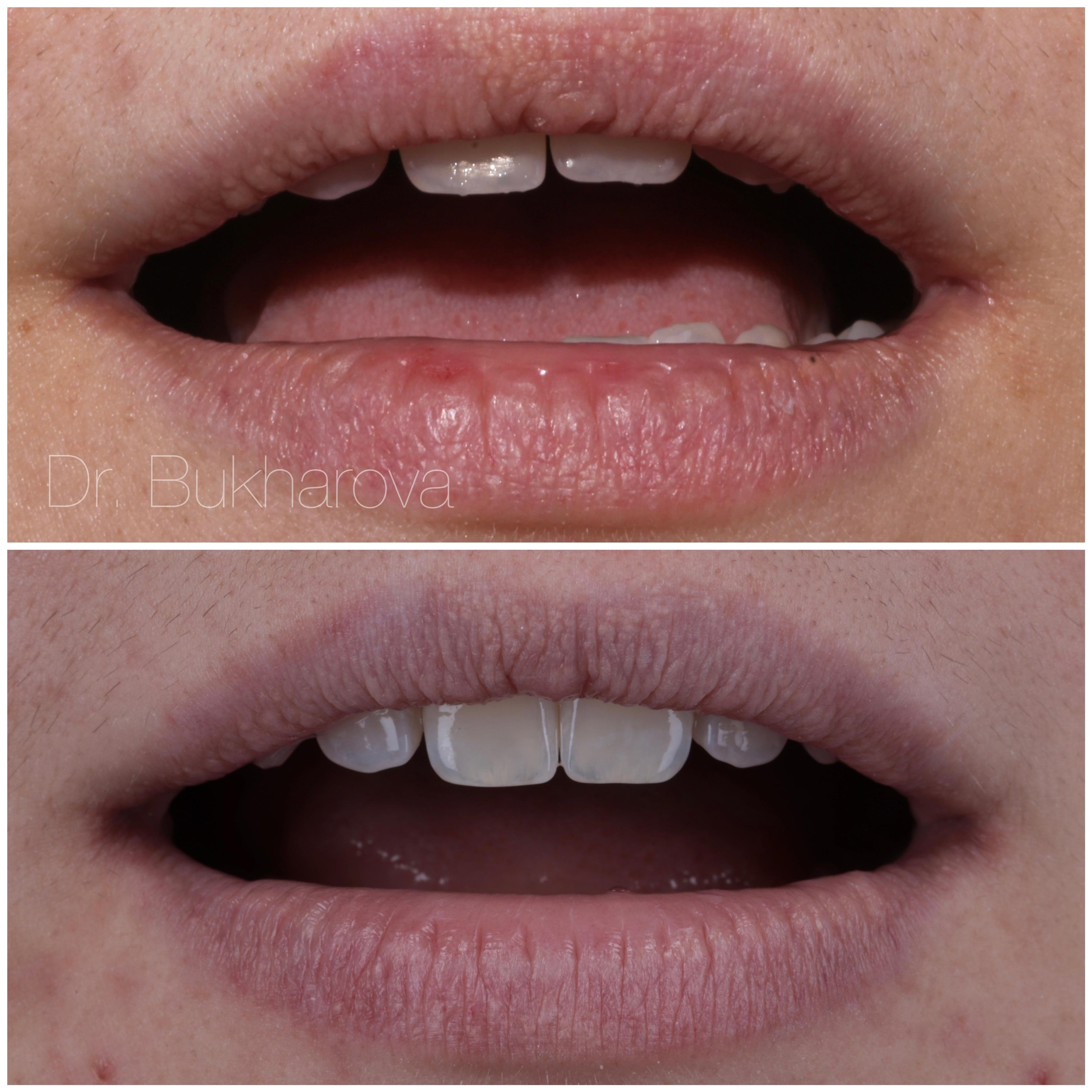 Ортодонтия. Стоматология в Твери - Линия Улыбки