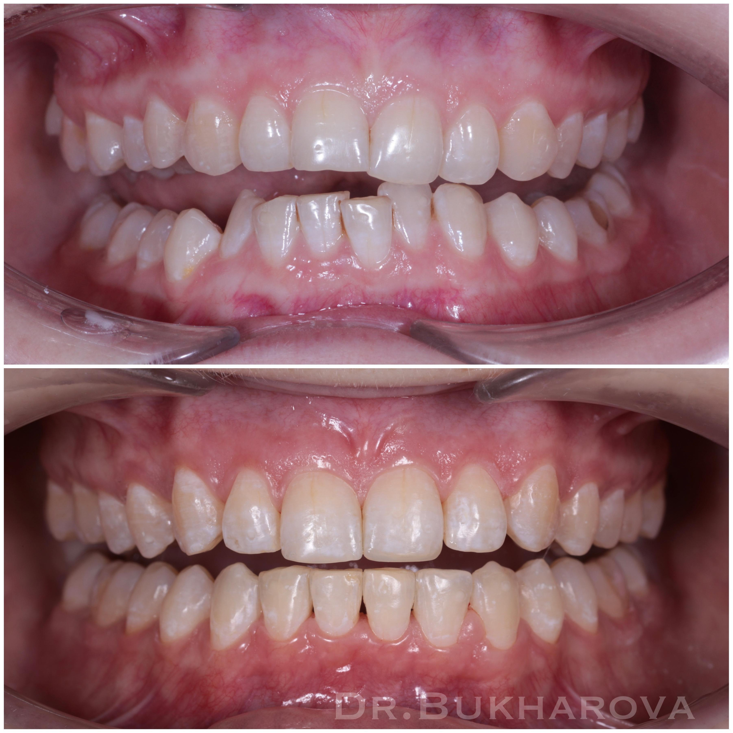 Ортодонтия. Стоматология в Твери - Линия Улыбки