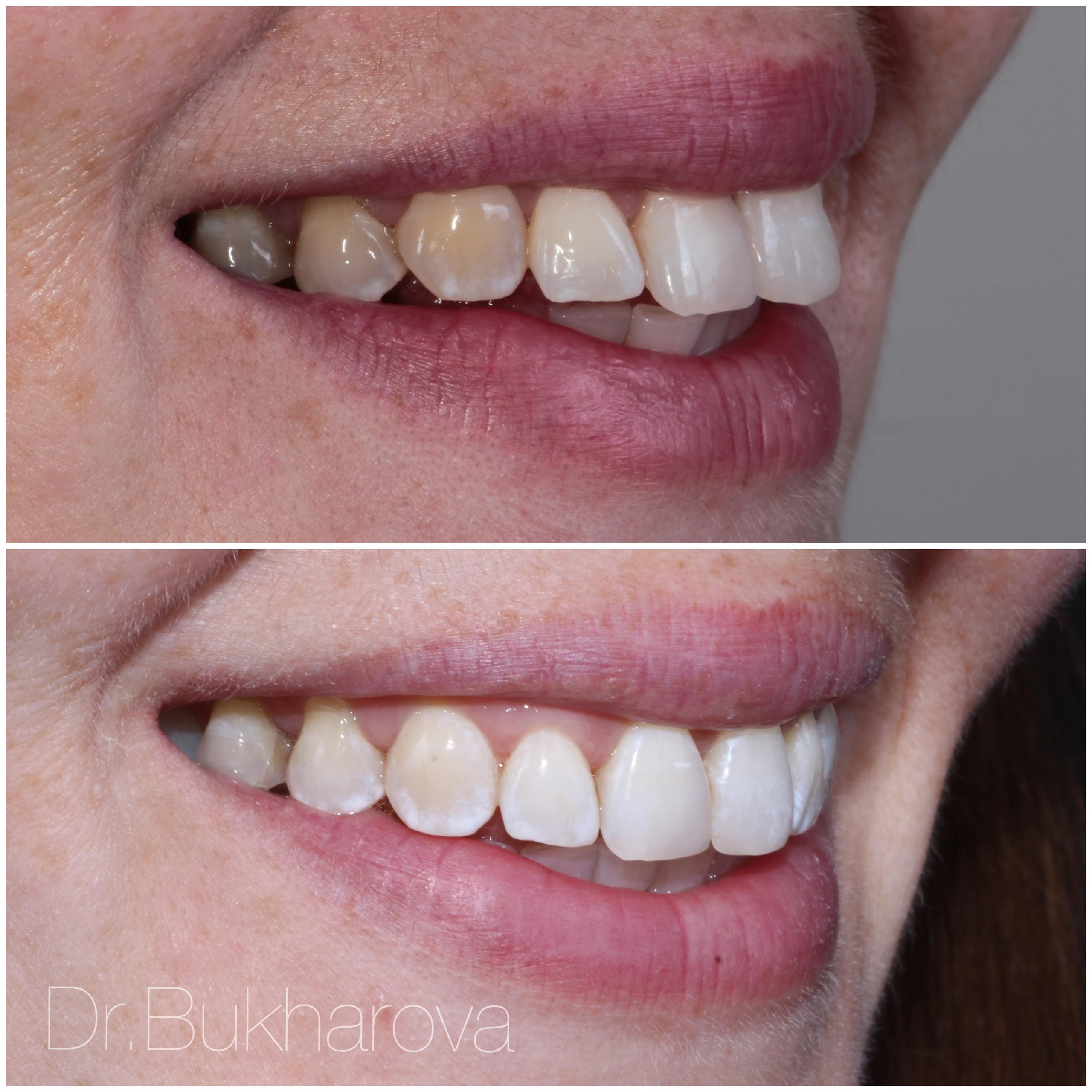 Ортодонтия. Стоматология в Твери - Линия Улыбки