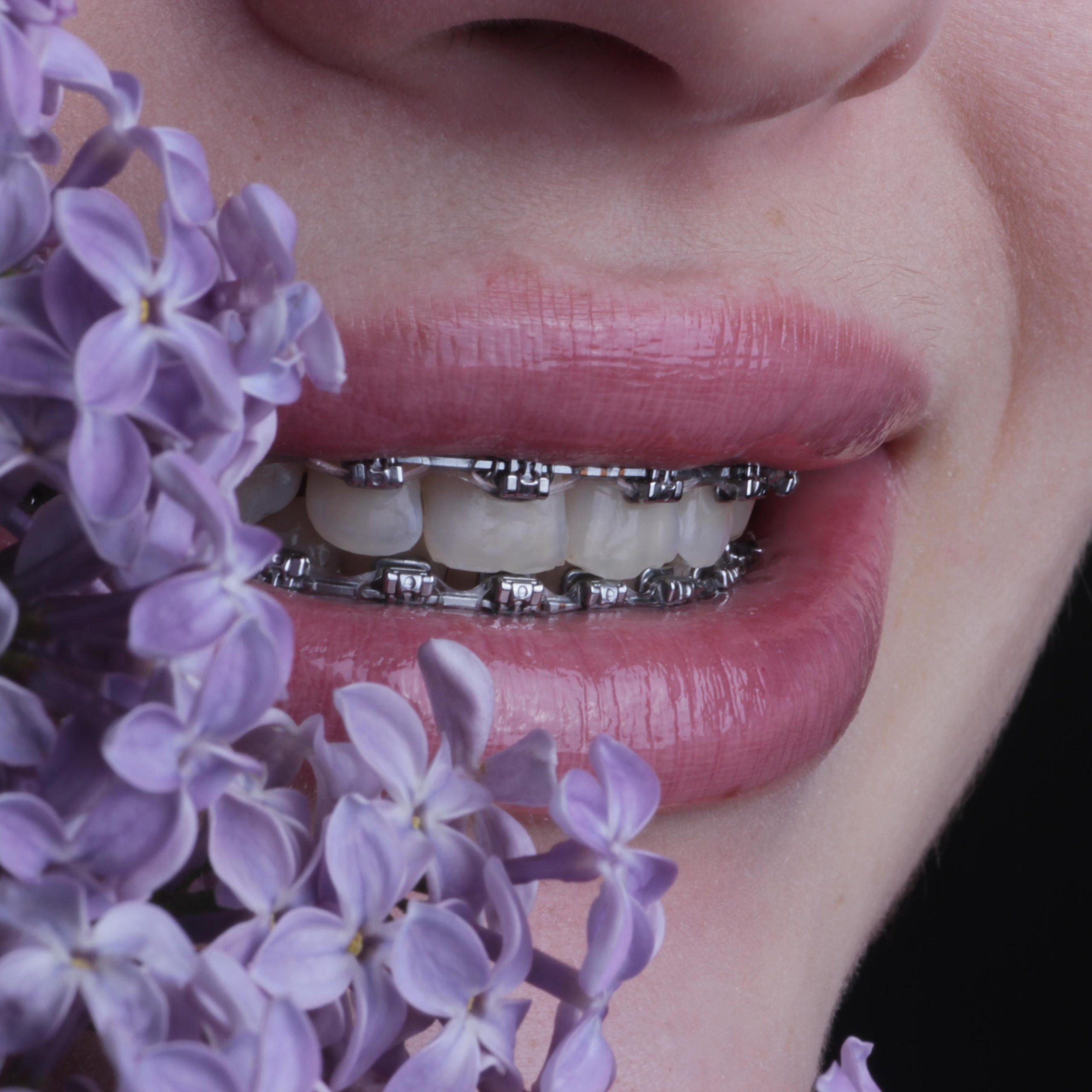 Ортодонтия. Стоматология в Твери - Линия Улыбки