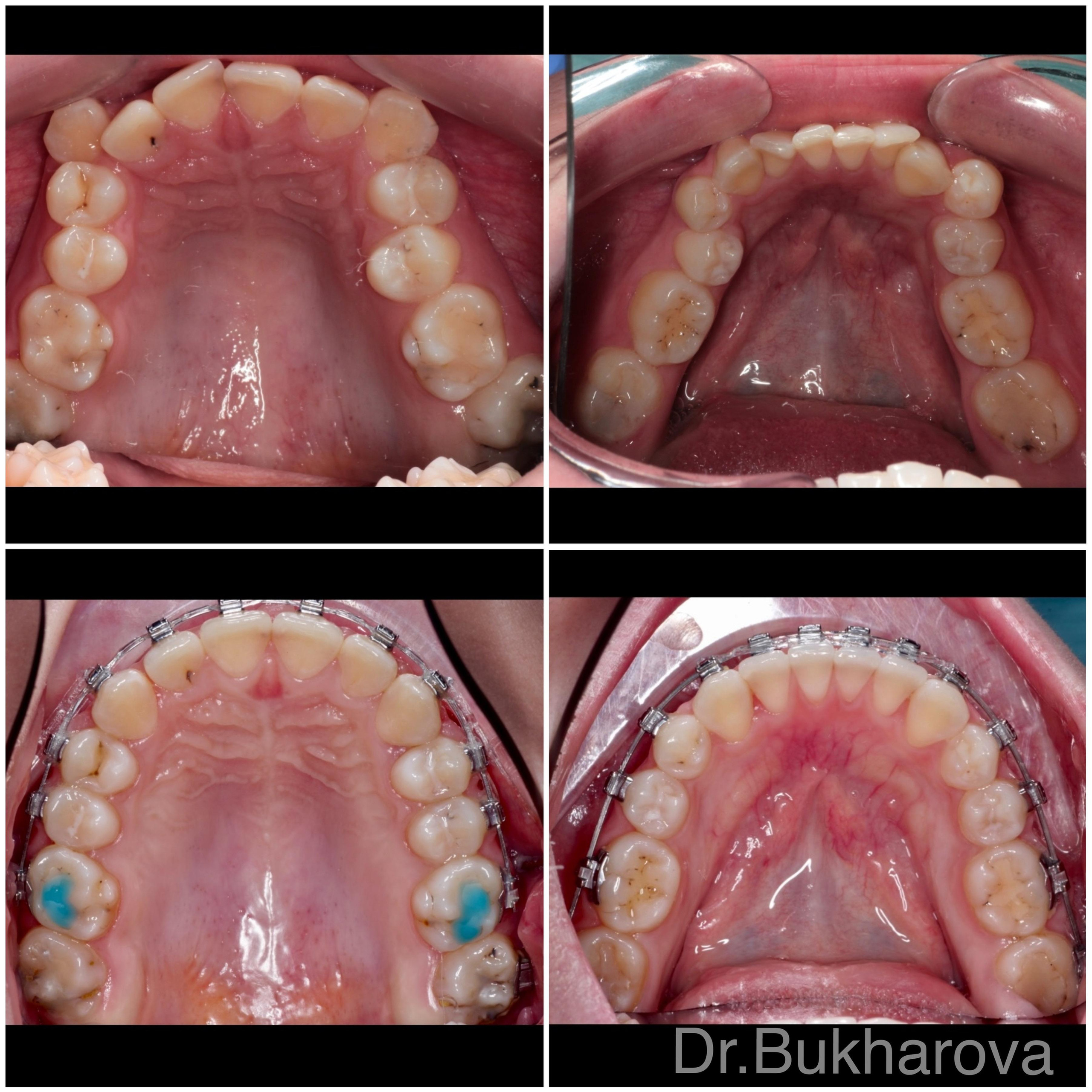 Ортодонтия. Стоматология в Твери - Линия Улыбки