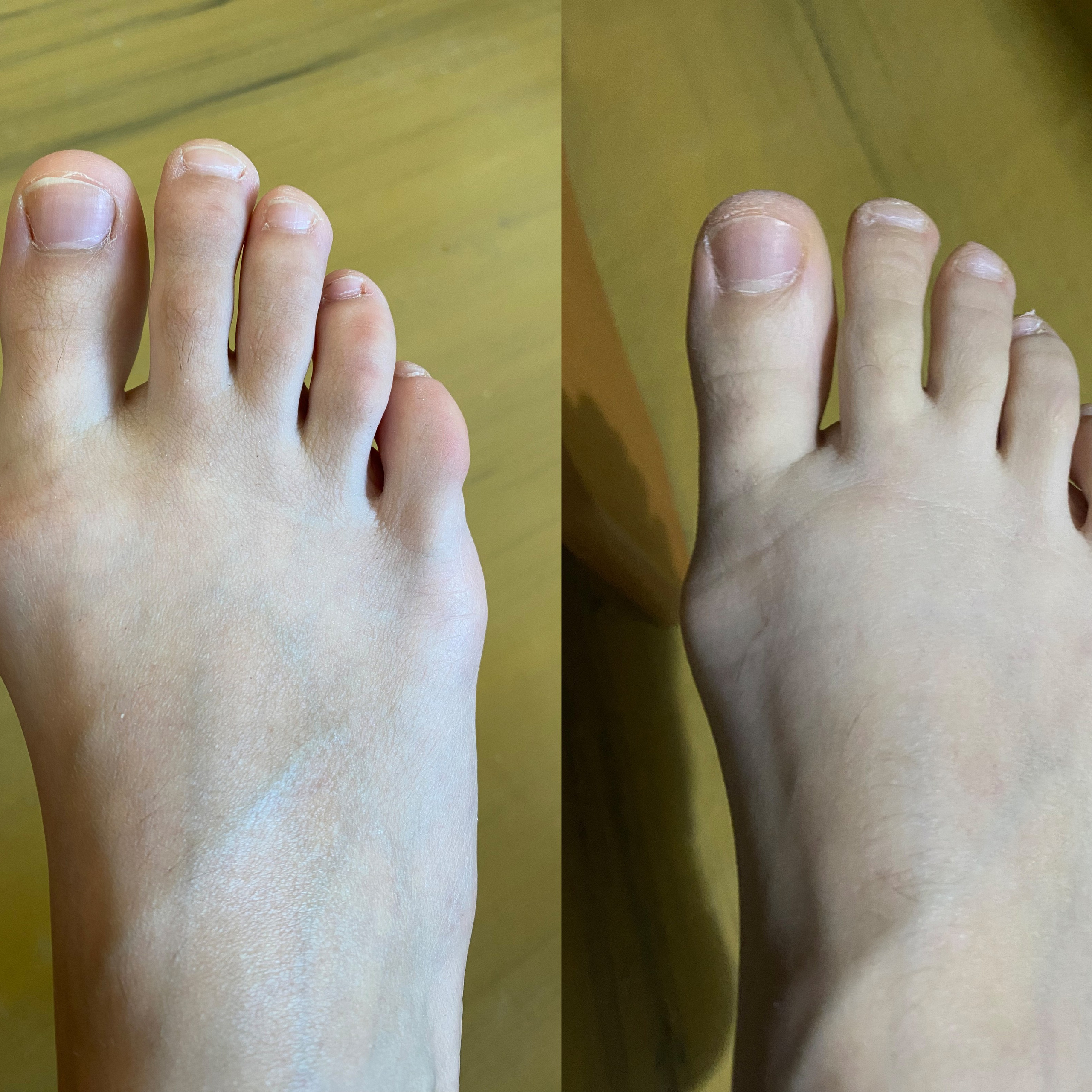 Растяжка 3.3. Via_photo