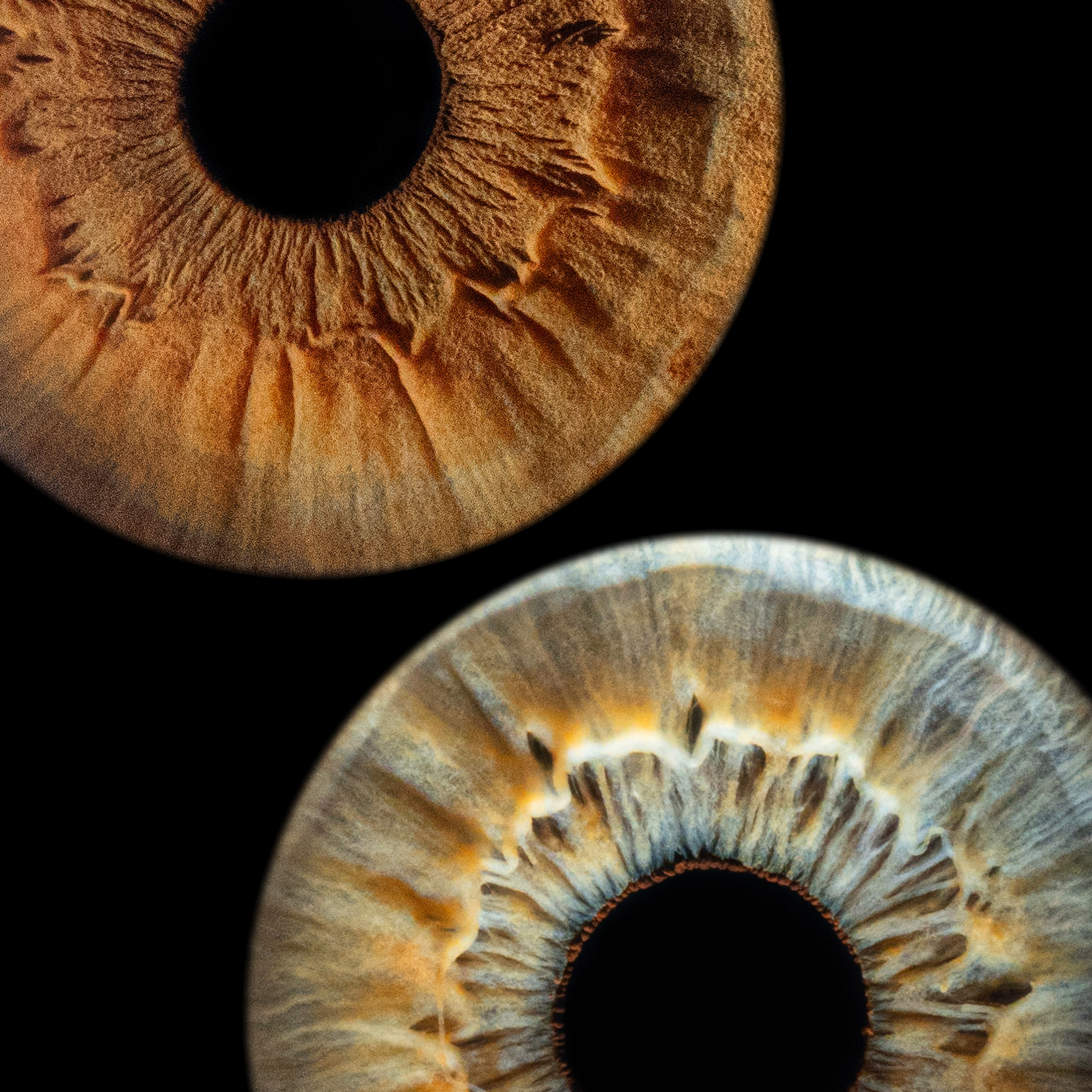 Отзывы. Мой глаз