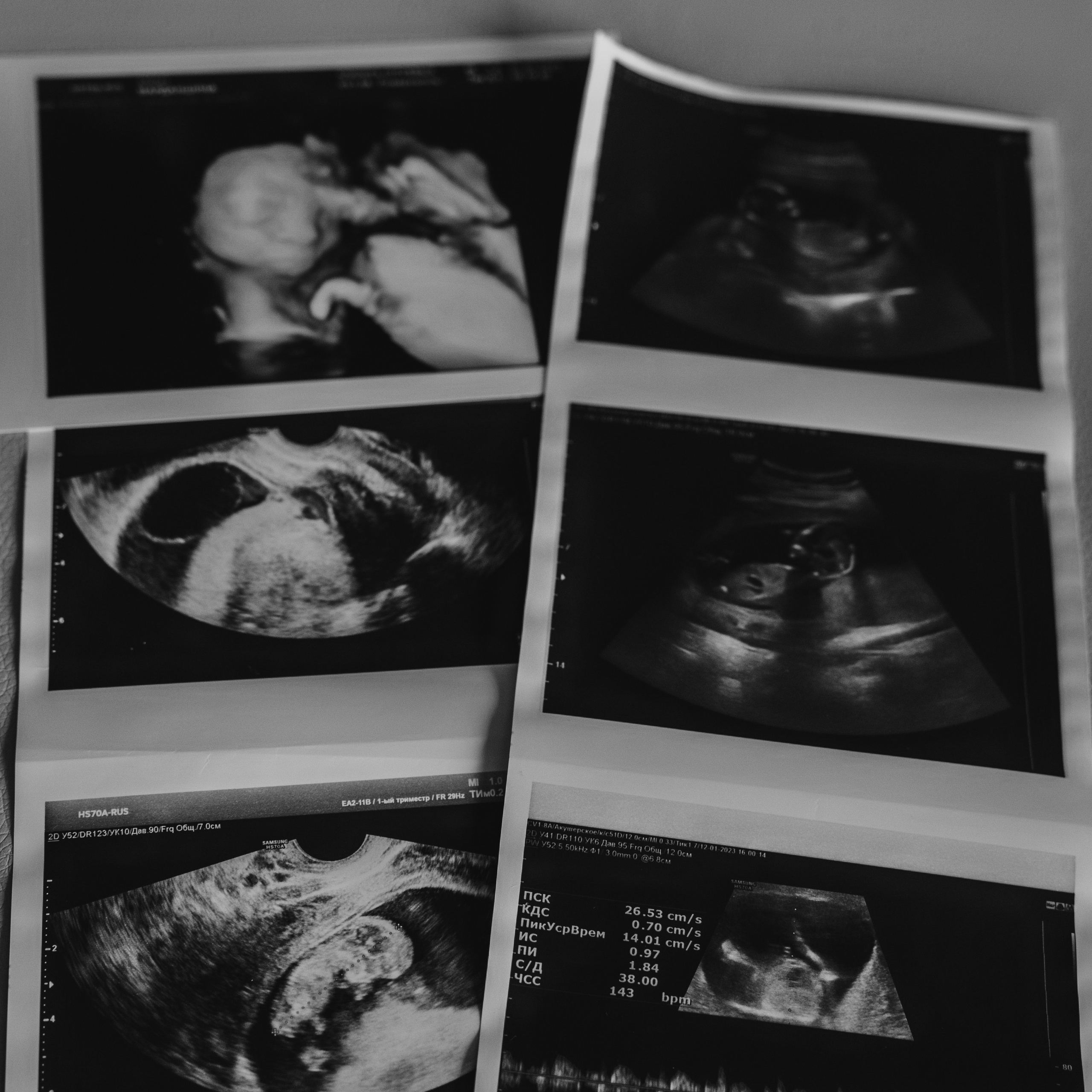 Отзывы счастливых родителей после съемок. Фотограф беременности и новорожденных Диляра Эстрина г. Альметьевск