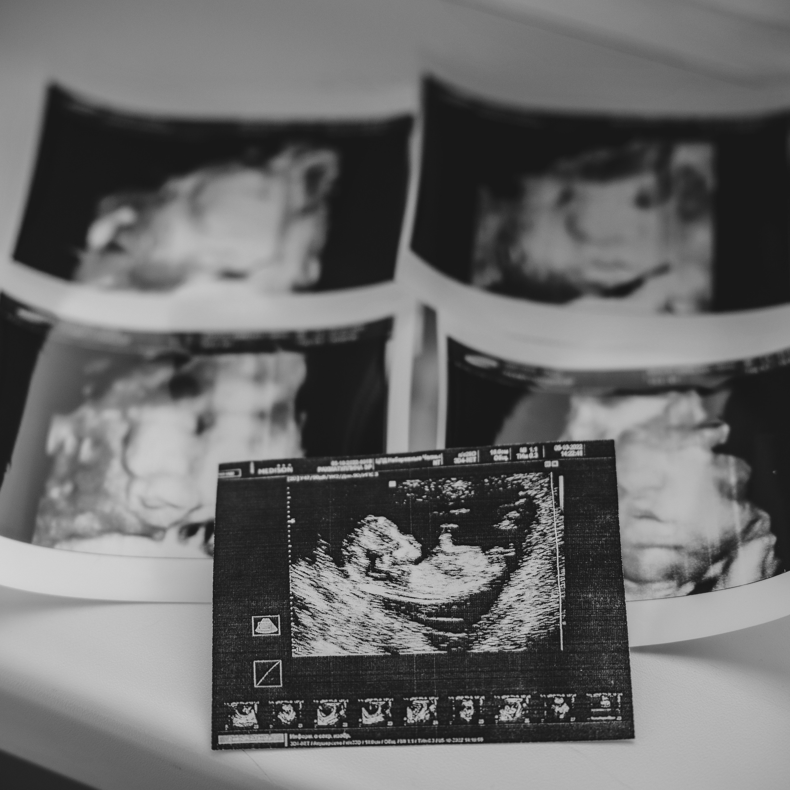 Отзывы счастливых родителей после съемок. Фотограф беременности и новорожденных Диляра Эстрина г. Альметьевск