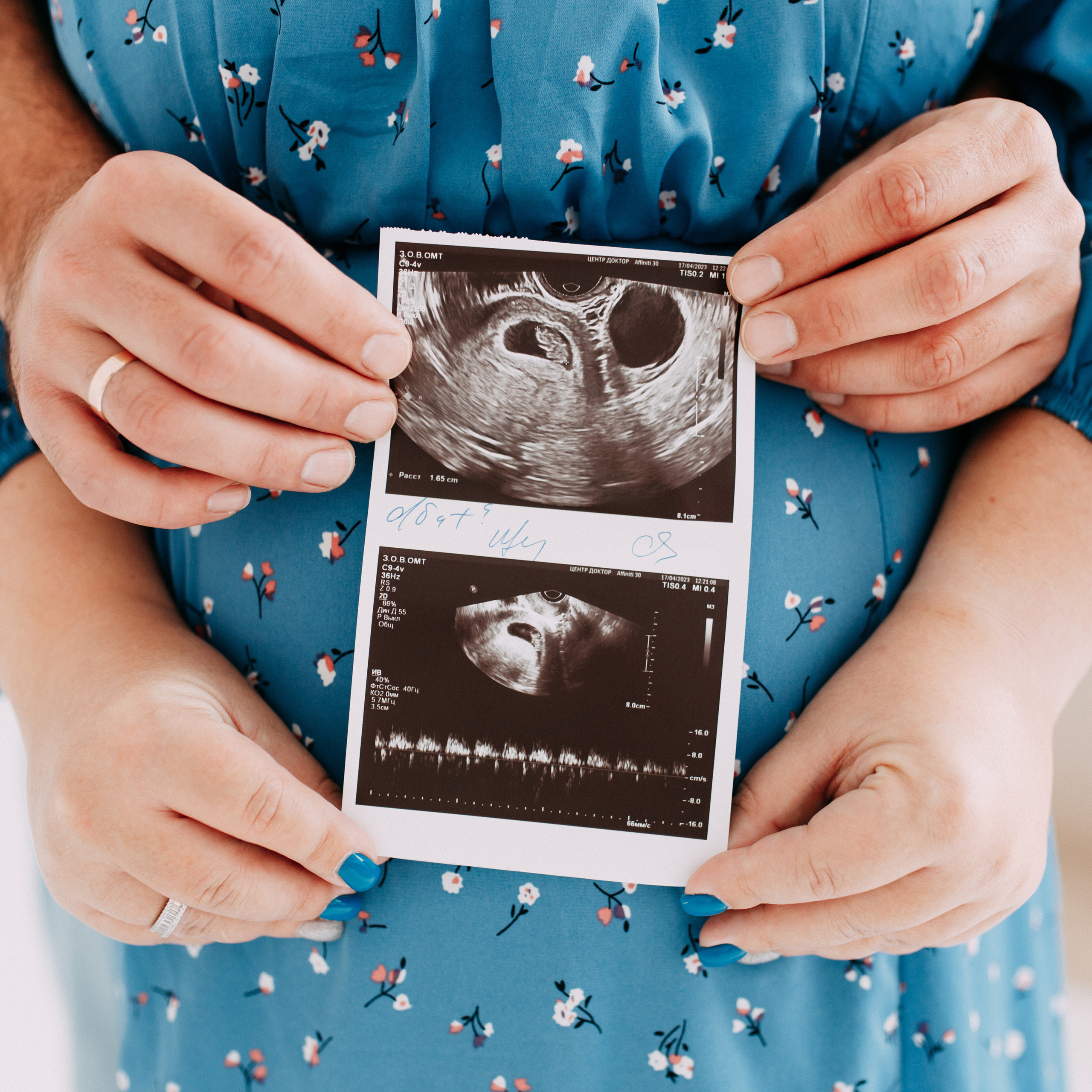 Семейный фотограф в Калининграде — отзывы. Фотограф в Калининграде Екатерина Осинцева