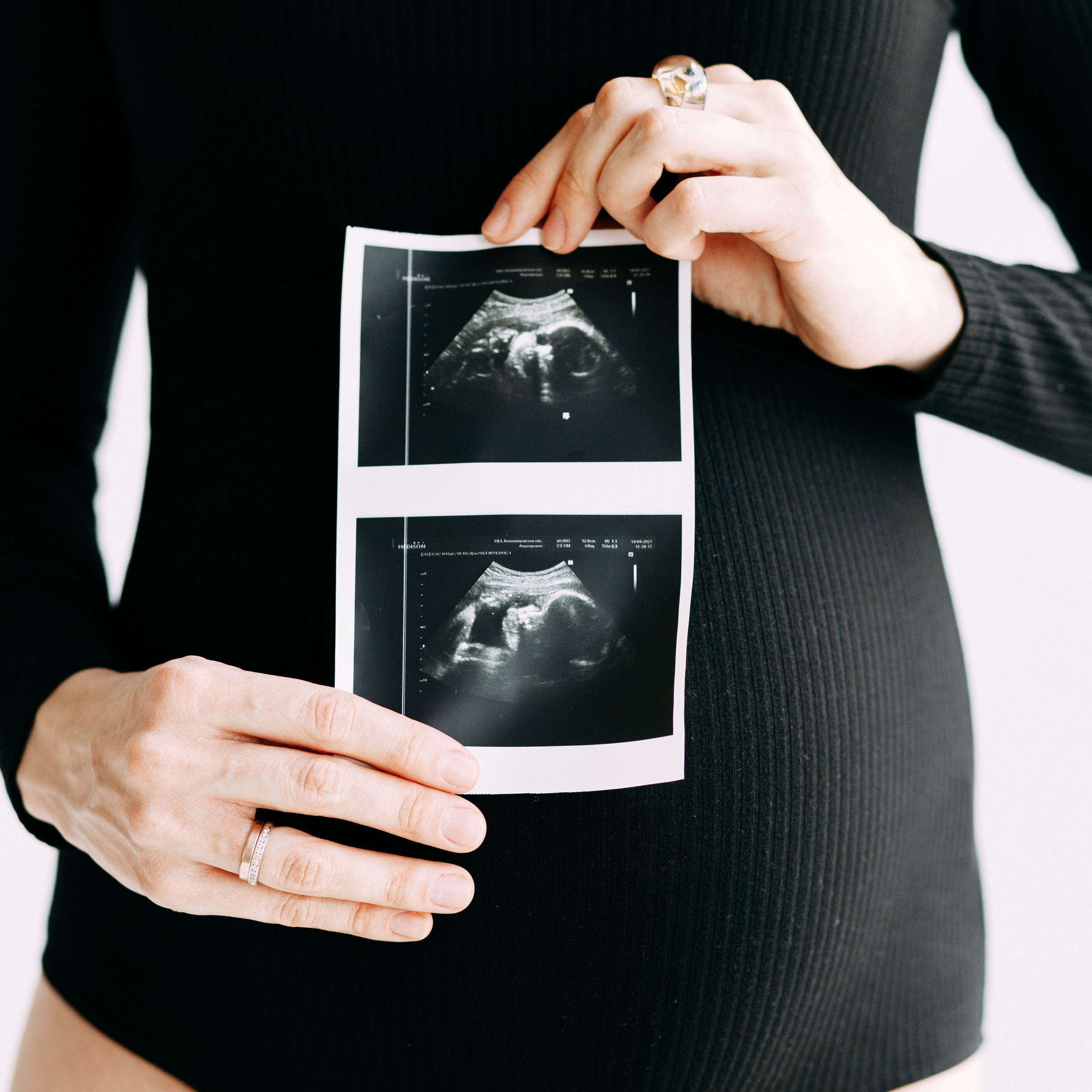 Семейный фотограф в Калининграде — отзывы. Фотограф в Калининграде Екатерина Осинцева