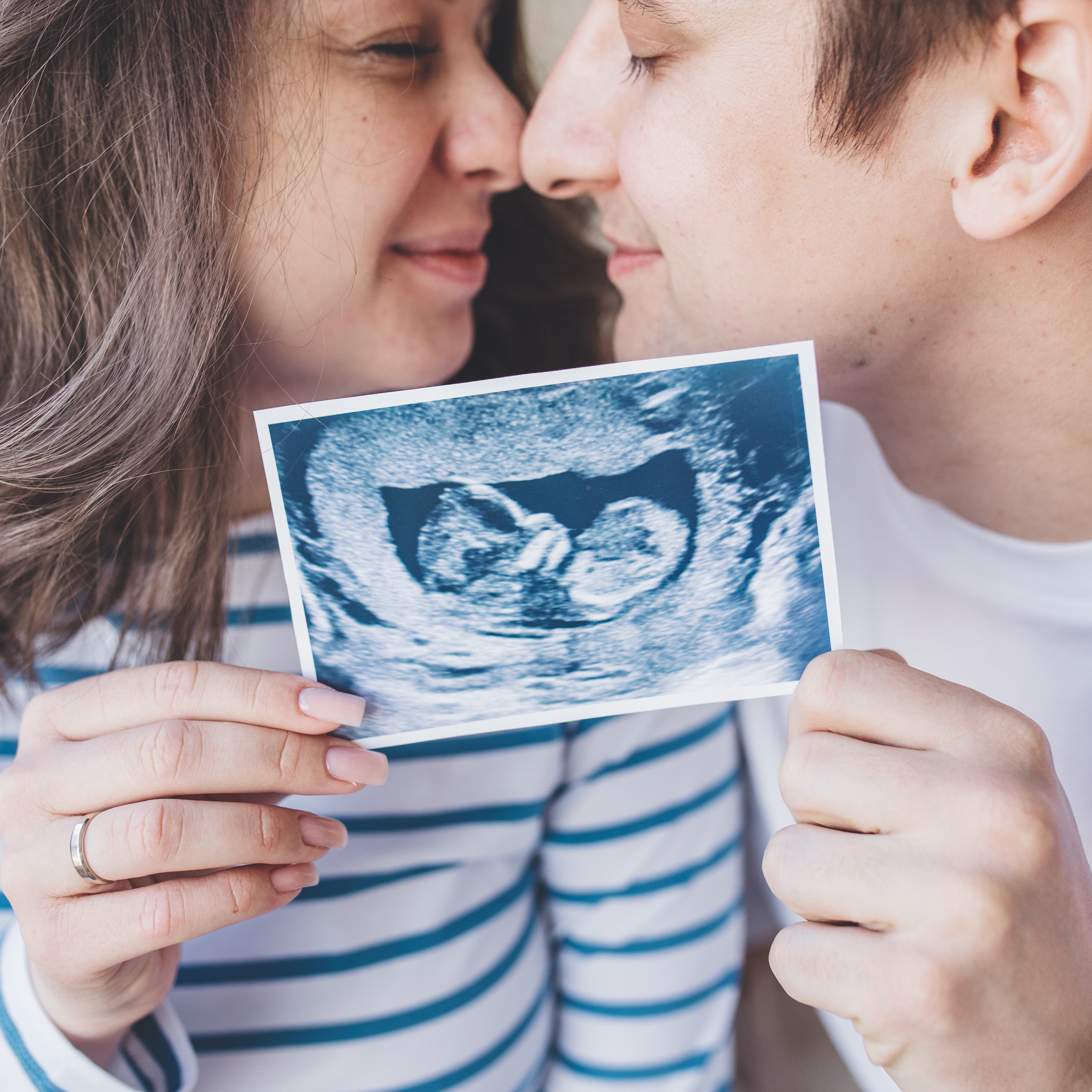 Կարծիքներ. Հարսանեկան լուսանկարչություն Հայաստանում Ադամյանների ընտանիքի կողմից