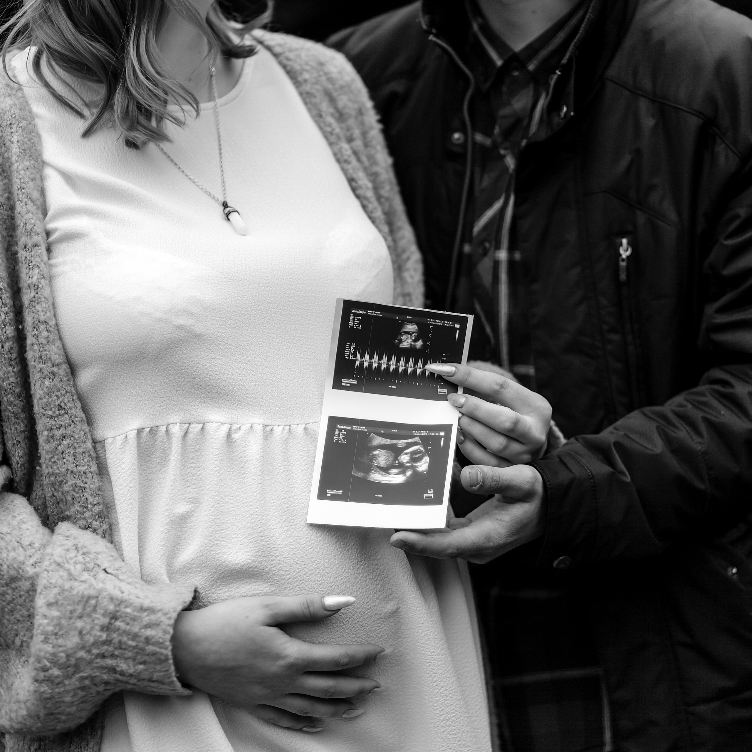 Отзывы. Свадебный фотограф в Пскове и Санкт-Петербурге | Анна Голикова