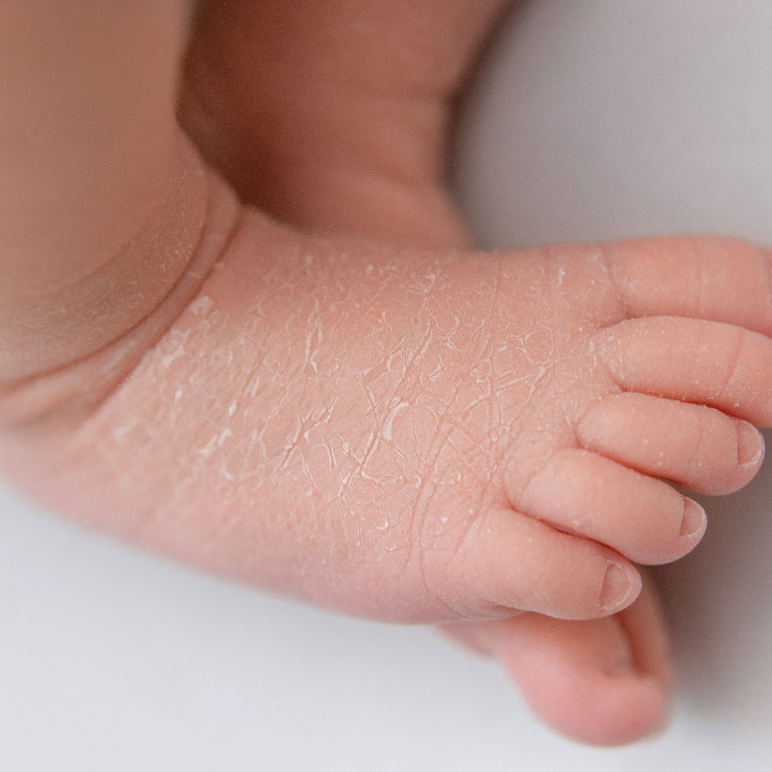 макроснимки ножек малыша