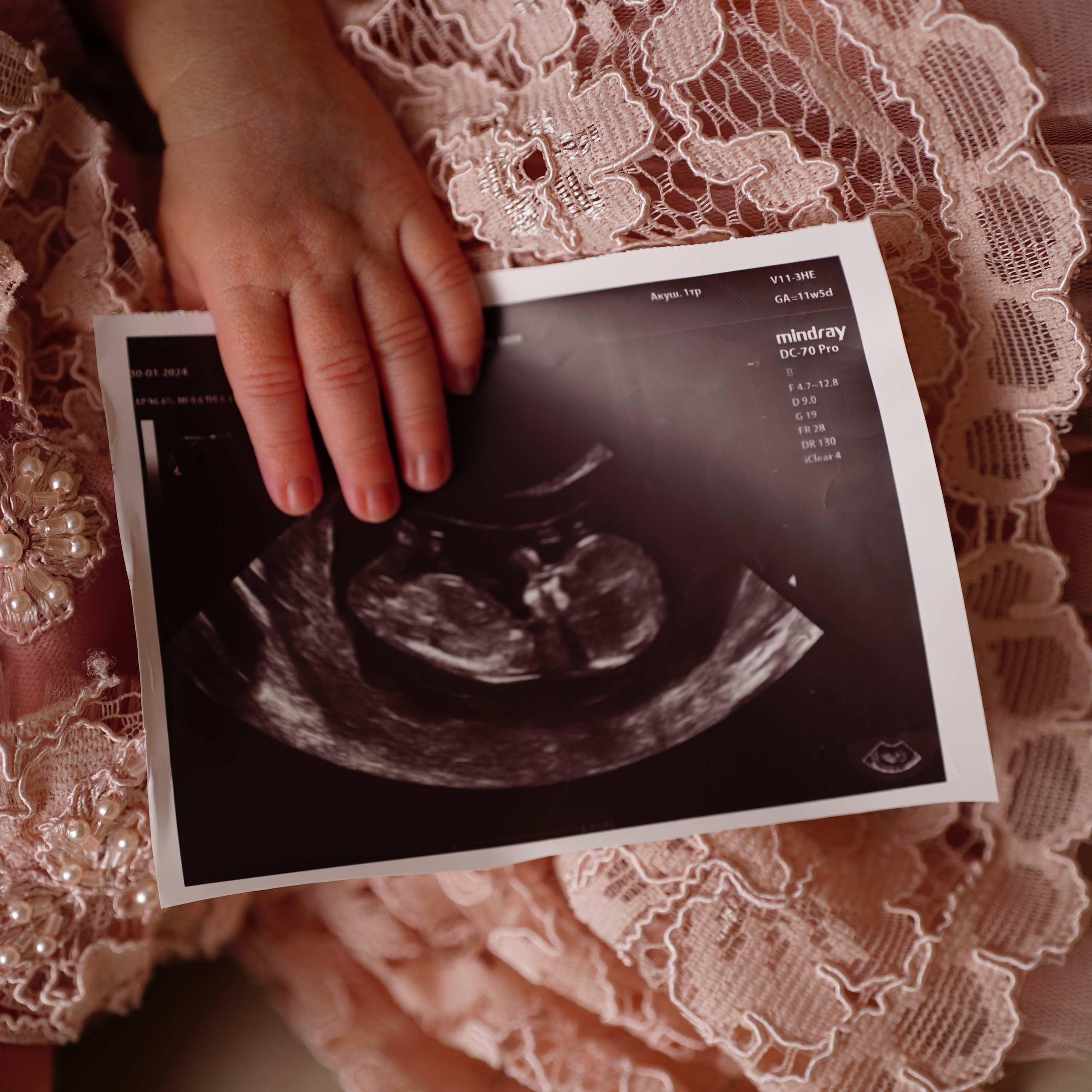 Отзывы о фотосессии новорожденных. Фотограф новорожденных в Нижнем Новгороде Сергеева Оксана