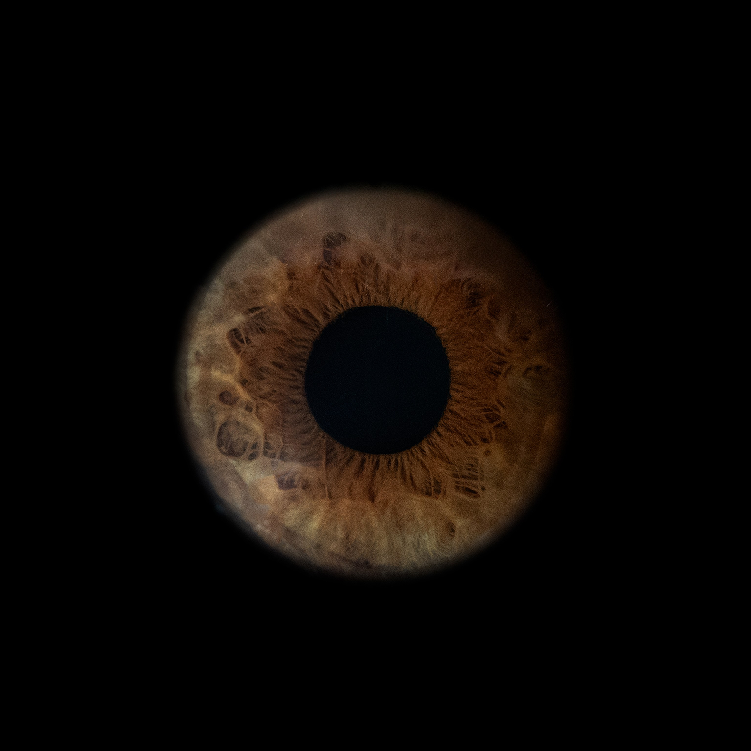 Портфолио — Галерея макрофотографий радужек глаза от Ojo Art, Севастополь. Фотостудия макросъёмки радужки глаз в Севастополе «Ojo art»