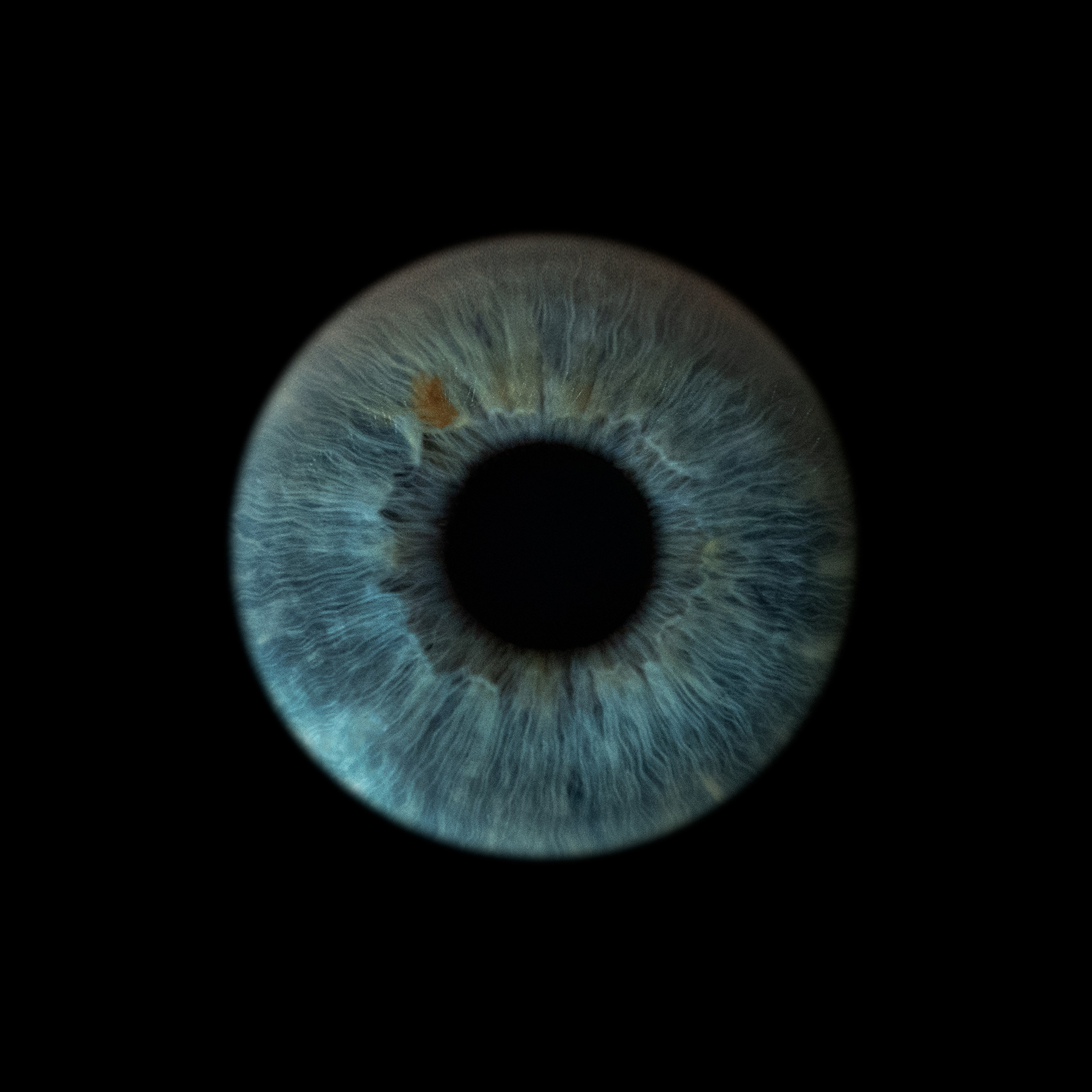 Портфолио — Галерея макрофотографий радужек глаза от Ojo Art, Севастополь. Фотостудия макросъёмки радужки глаз в Севастополе «Ojo art»