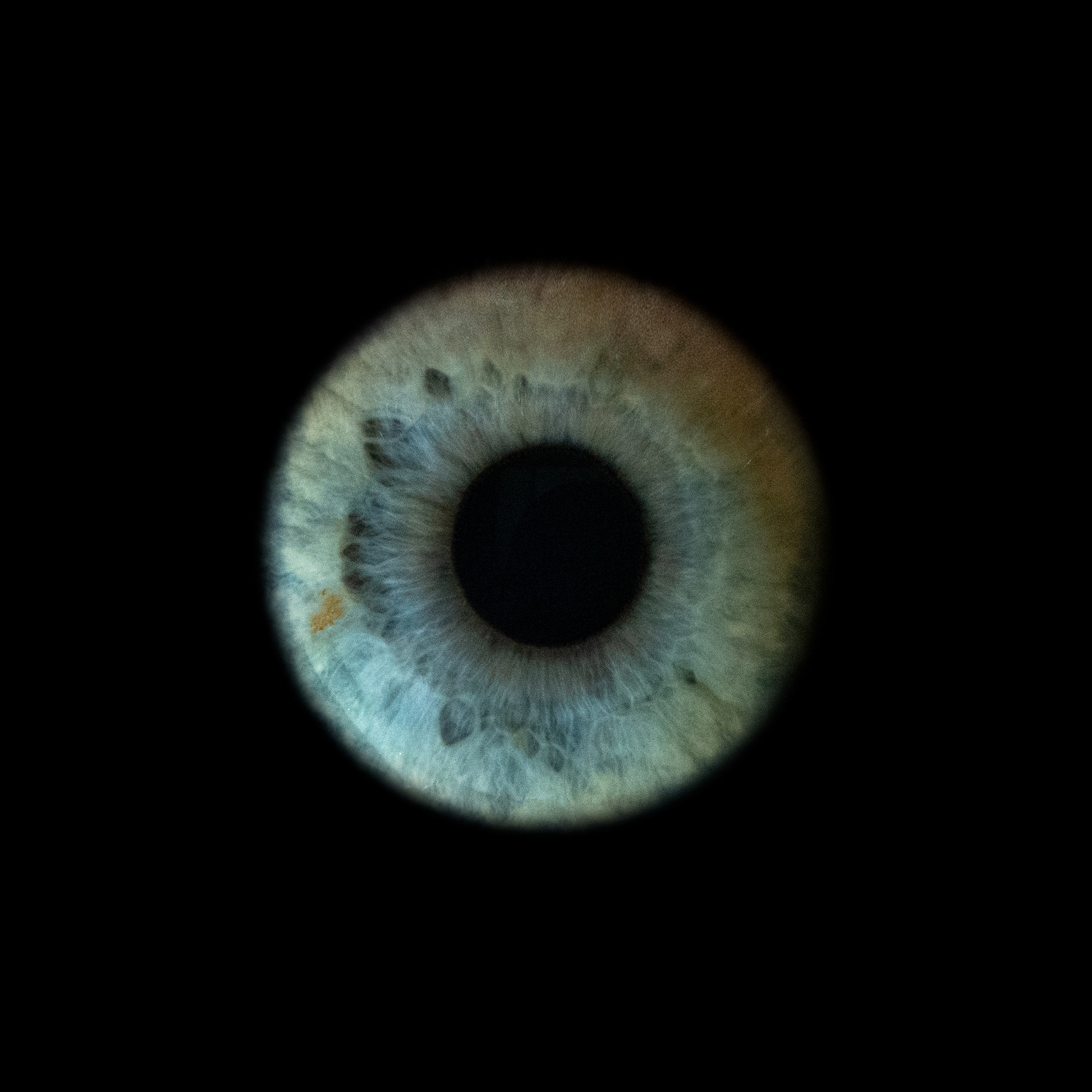 Портфолио — Галерея макрофотографий радужек глаза от Ojo Art, Севастополь. Фотостудия макросъёмки радужки глаз в Севастополе «Ojo art»