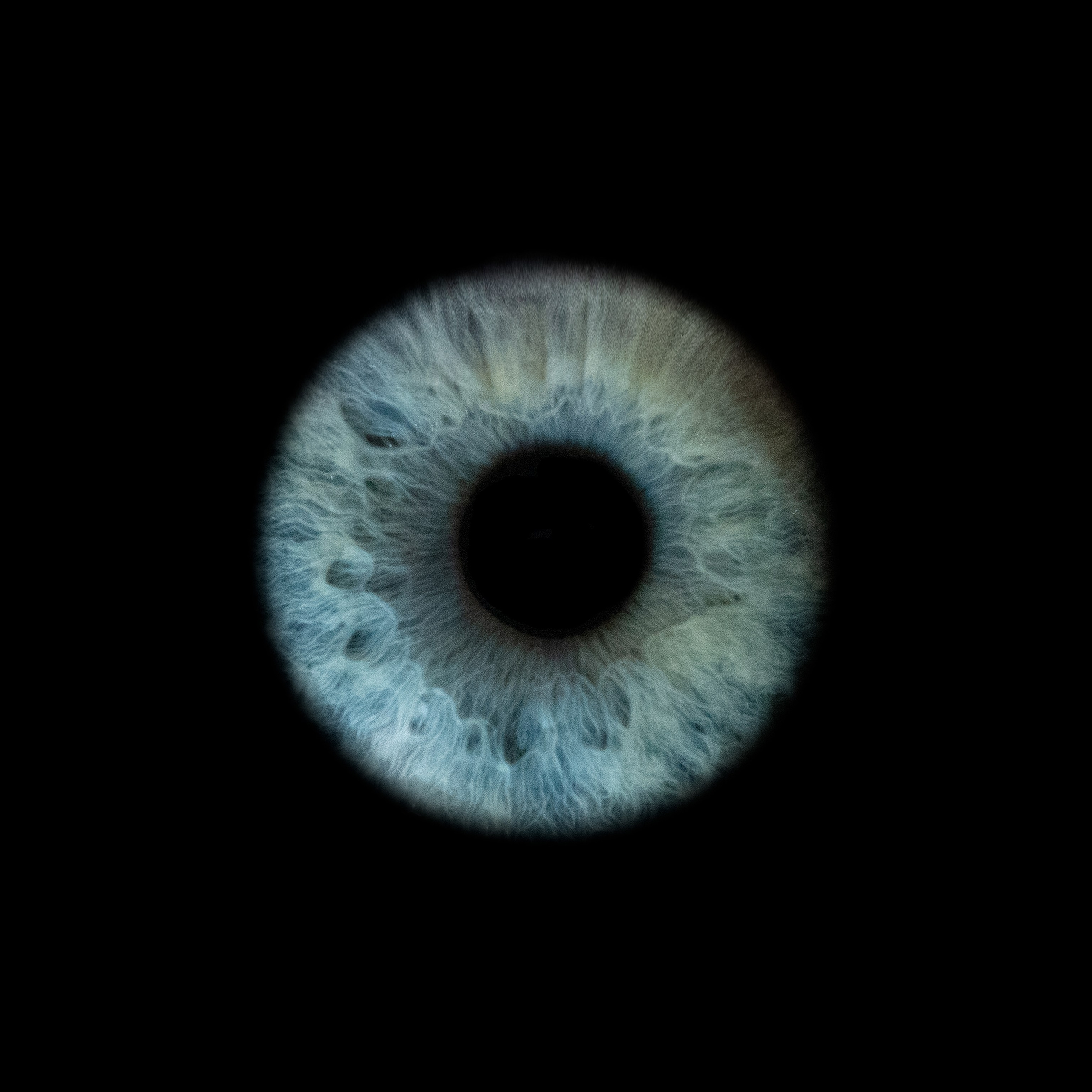 Портфолио — Галерея макрофотографий радужек глаза от Ojo Art, Севастополь. Фотостудия макросъёмки радужки глаз в Севастополе «Ojo art»