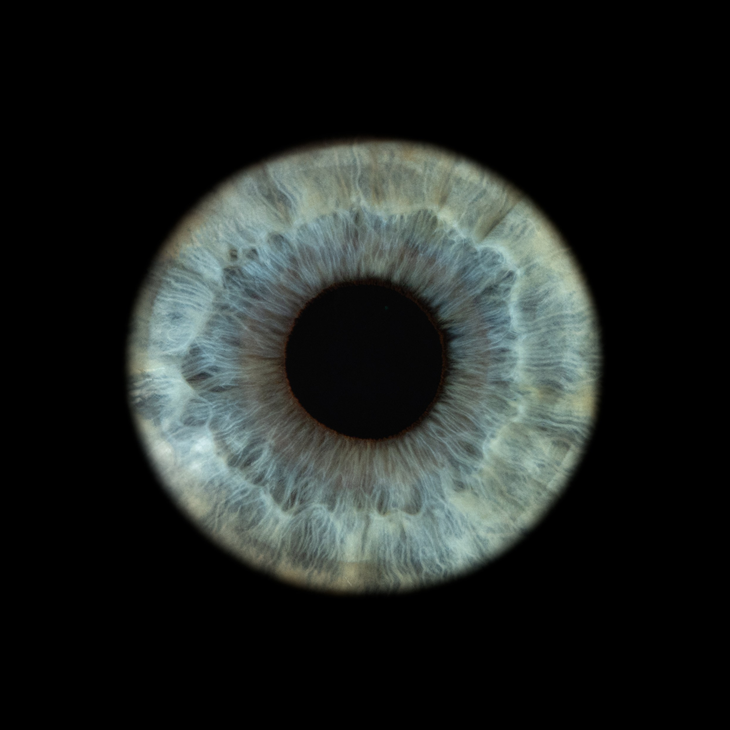 Портфолио — Галерея макрофотографий радужек глаза от Ojo Art, Севастополь. Фотостудия макросъёмки радужки глаз в Севастополе «Ojo art»