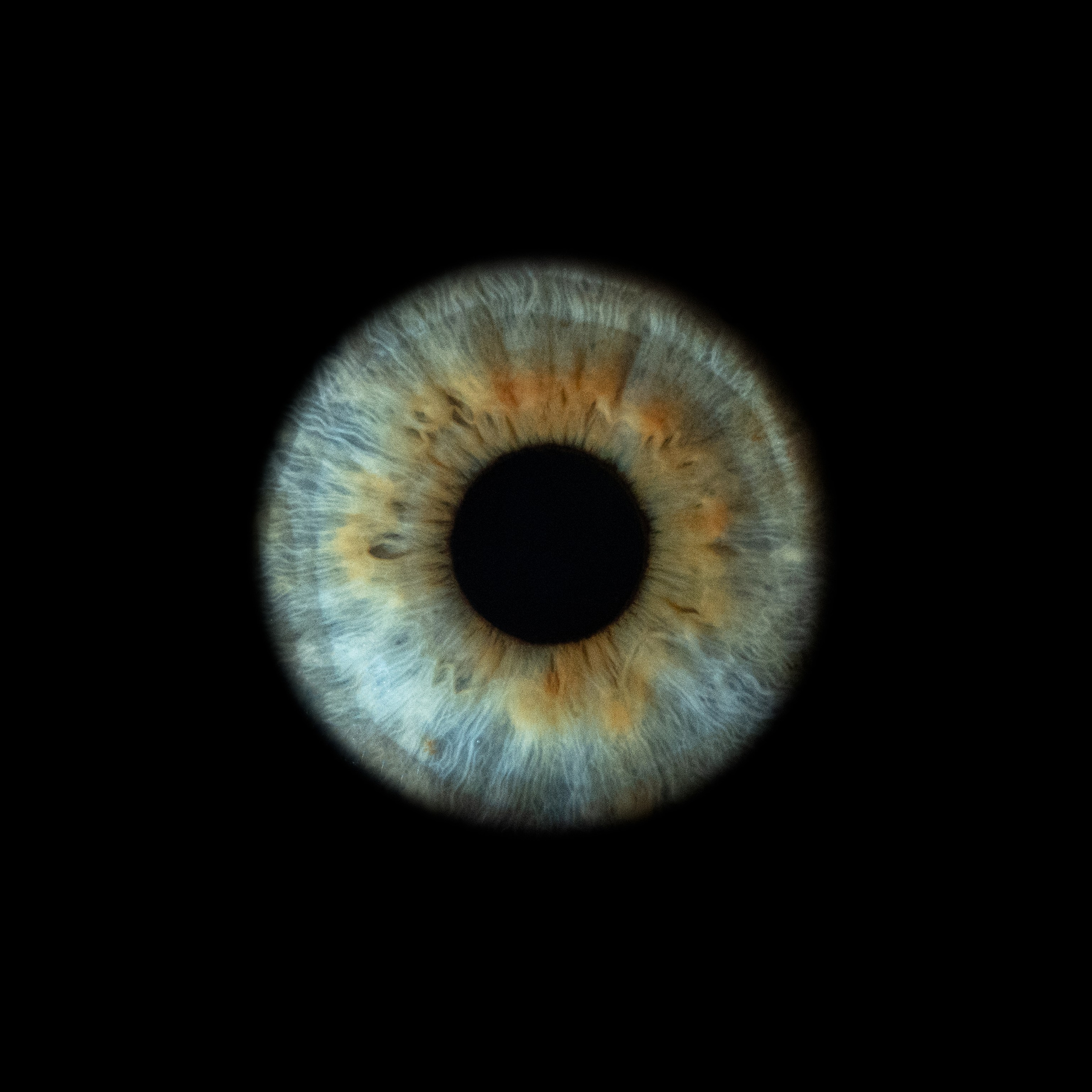 Портфолио — Галерея макрофотографий радужек глаза от Ojo Art, Севастополь. Фотостудия макросъёмки радужки глаз в Севастополе «Ojo art»