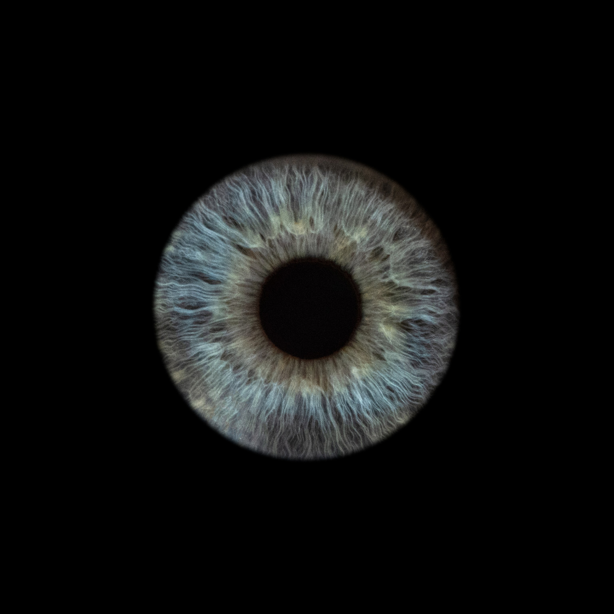 Портфолио — Галерея макрофотографий радужек глаза от Ojo Art, Севастополь. Фотостудия макросъёмки радужки глаз в Севастополе «Ojo art»