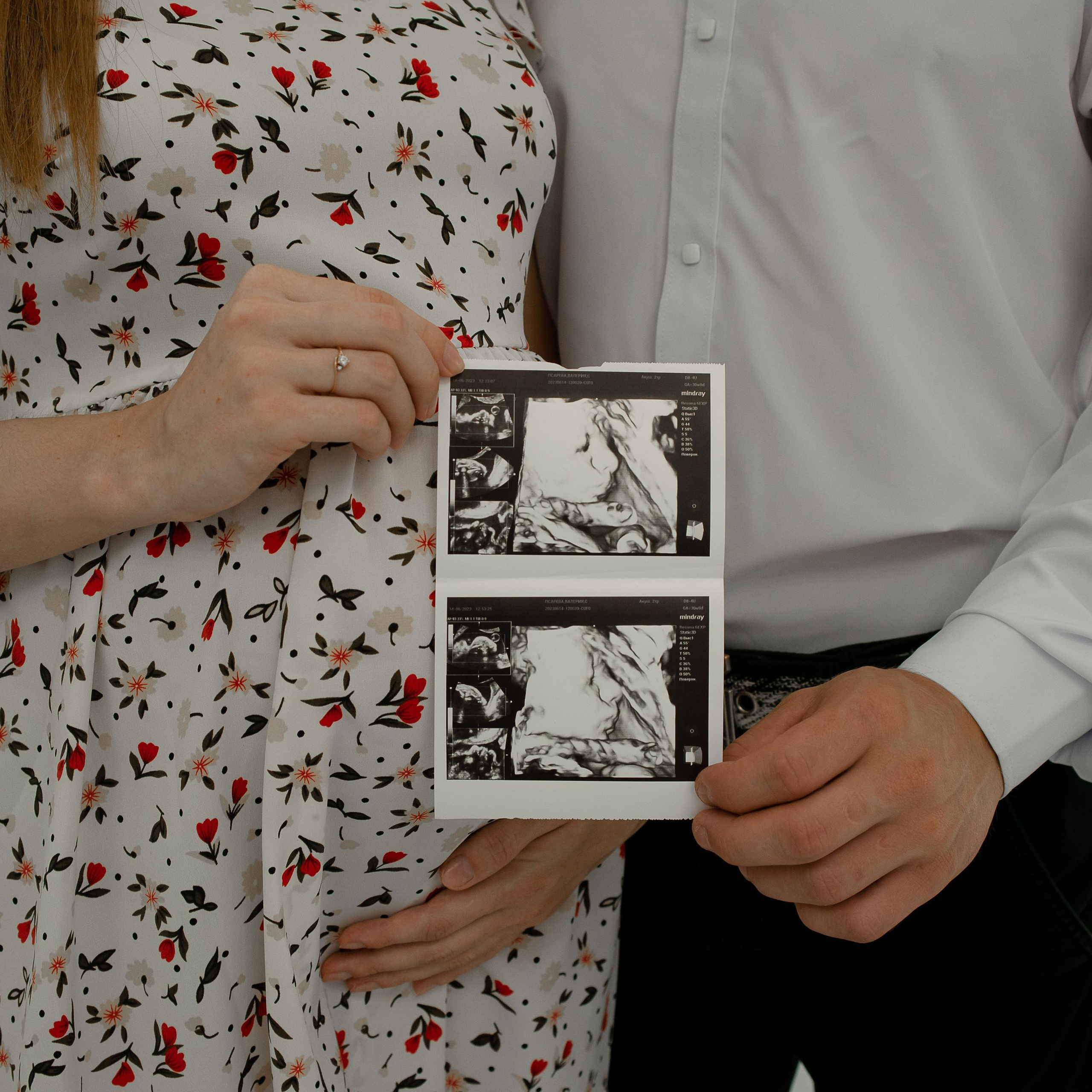 Отзывы. Свадебный и семейный фотограф Гришина Галина, п. Орловский