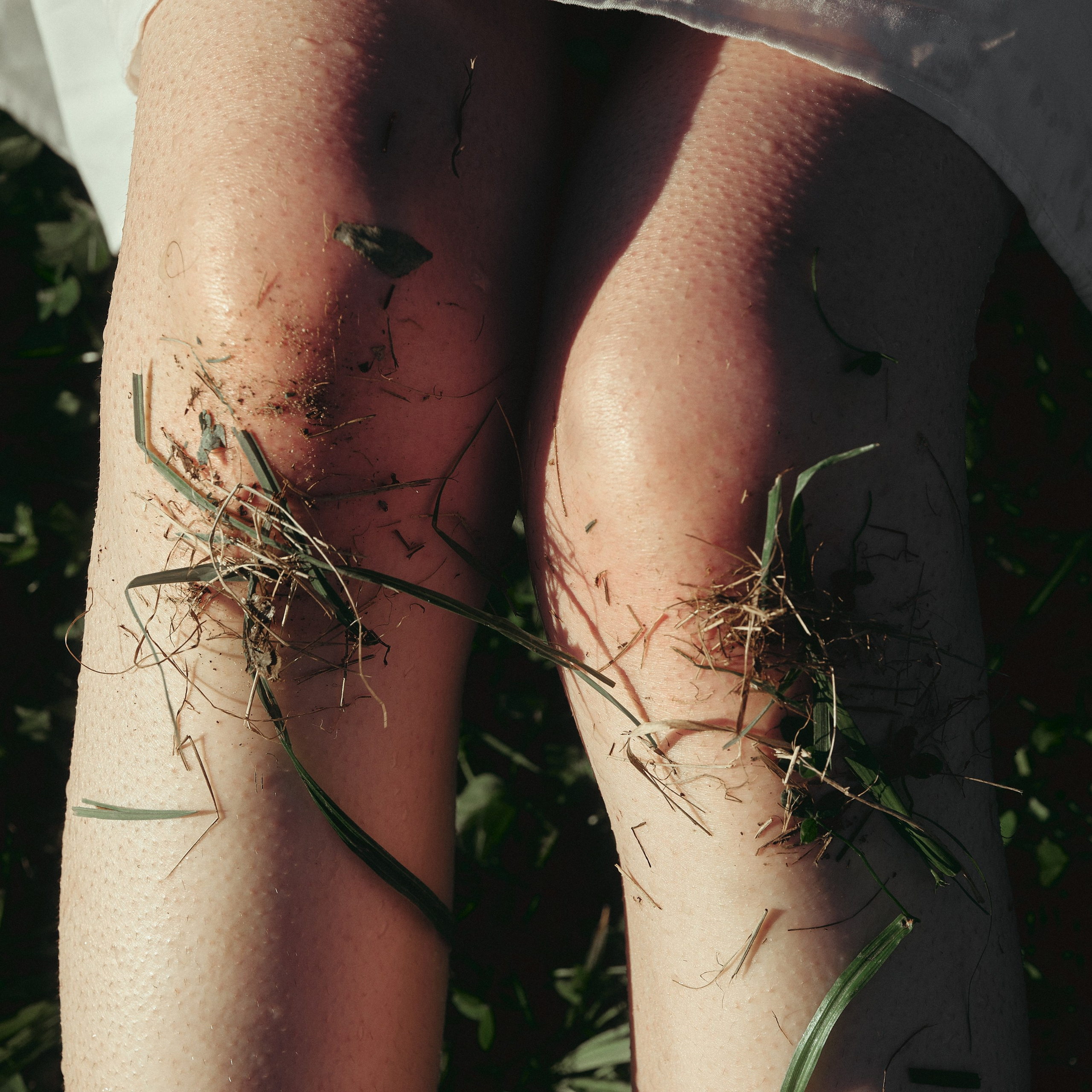 Кожа в которой я живу. Эльдар Март — Visual artist