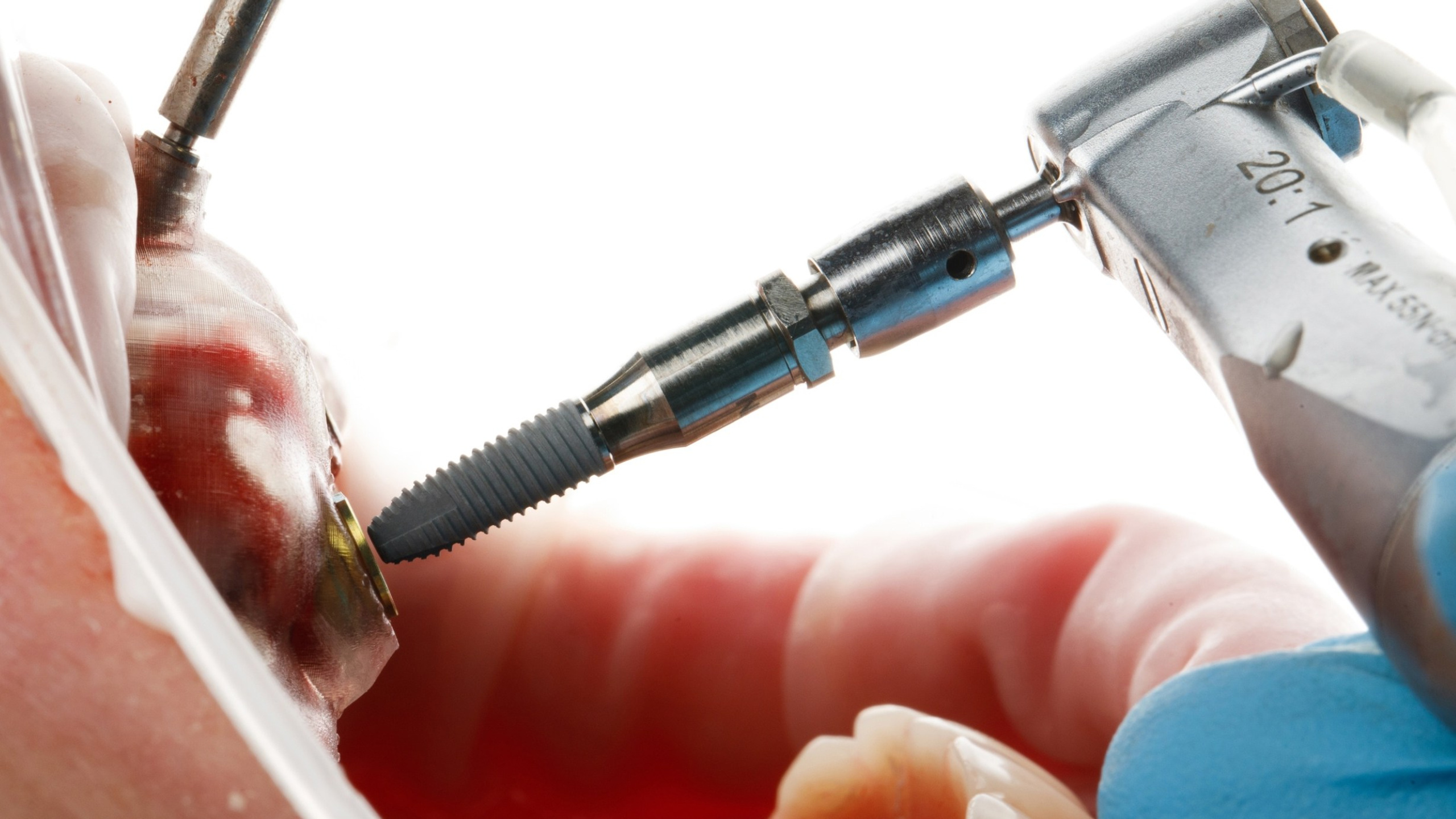 Операции Видео!. Дентал фотограф — видеограф Денис Дорошенко