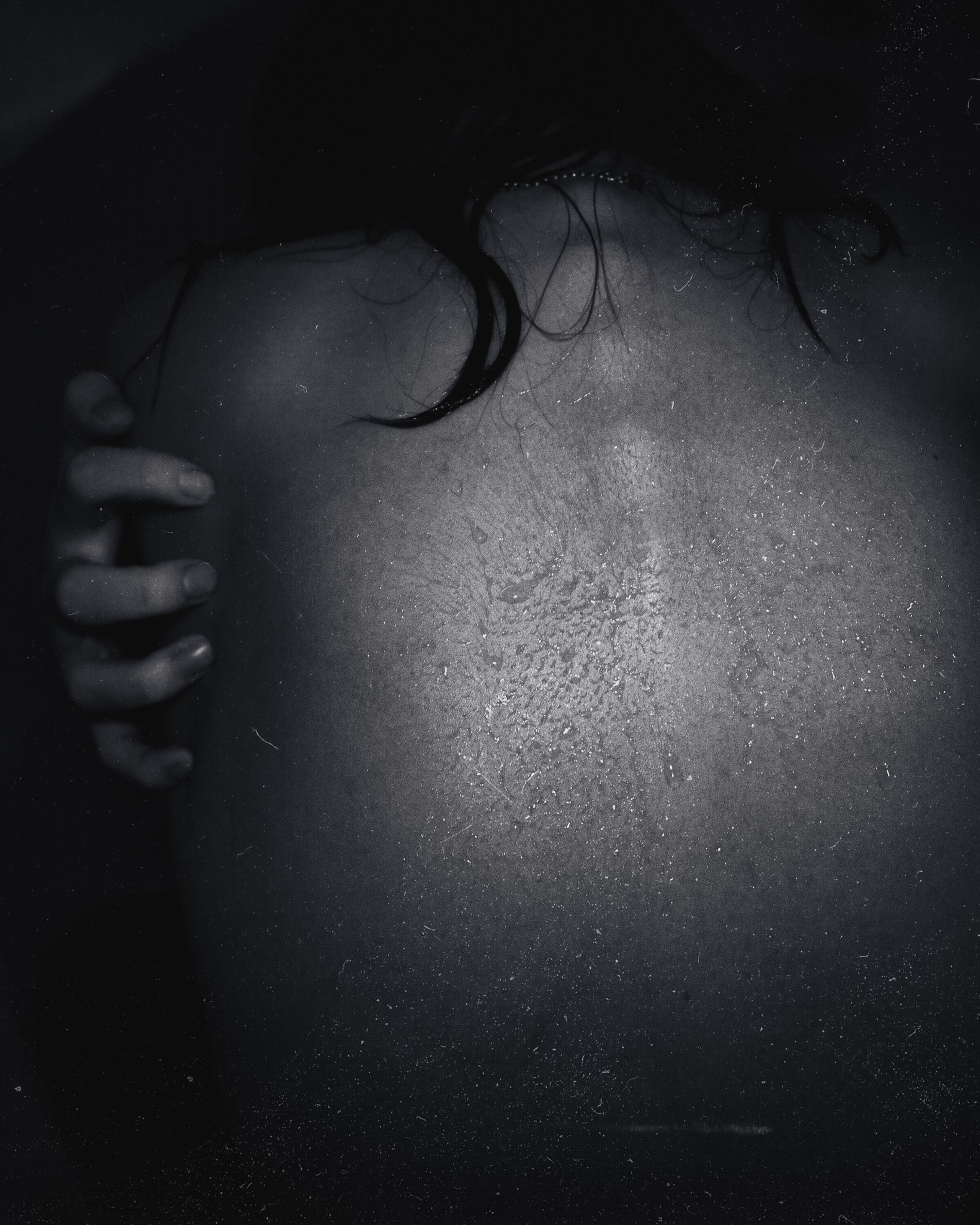 Asphyxia