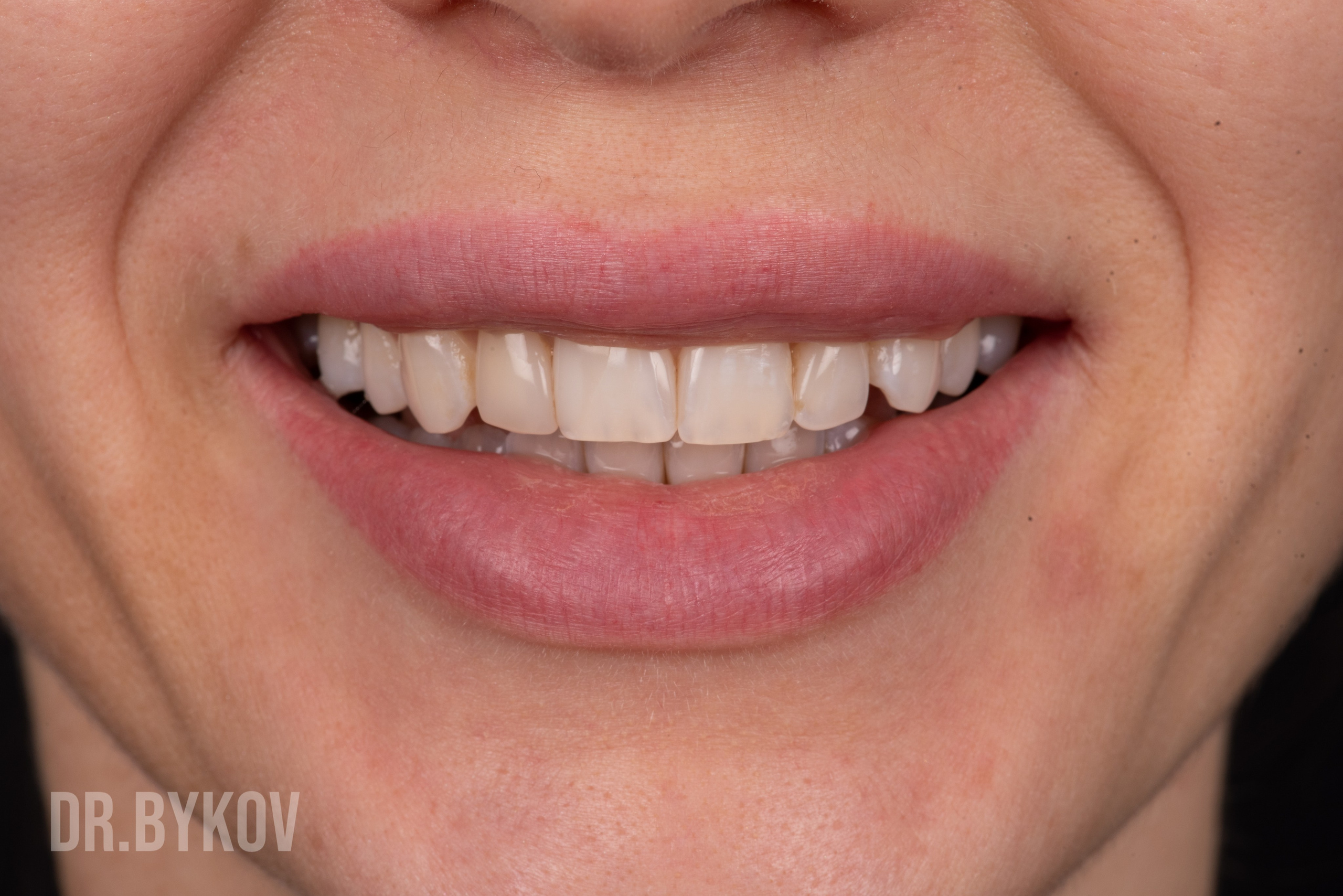 Портфолио. Врач стоматолог-ортопед Быков Алексей