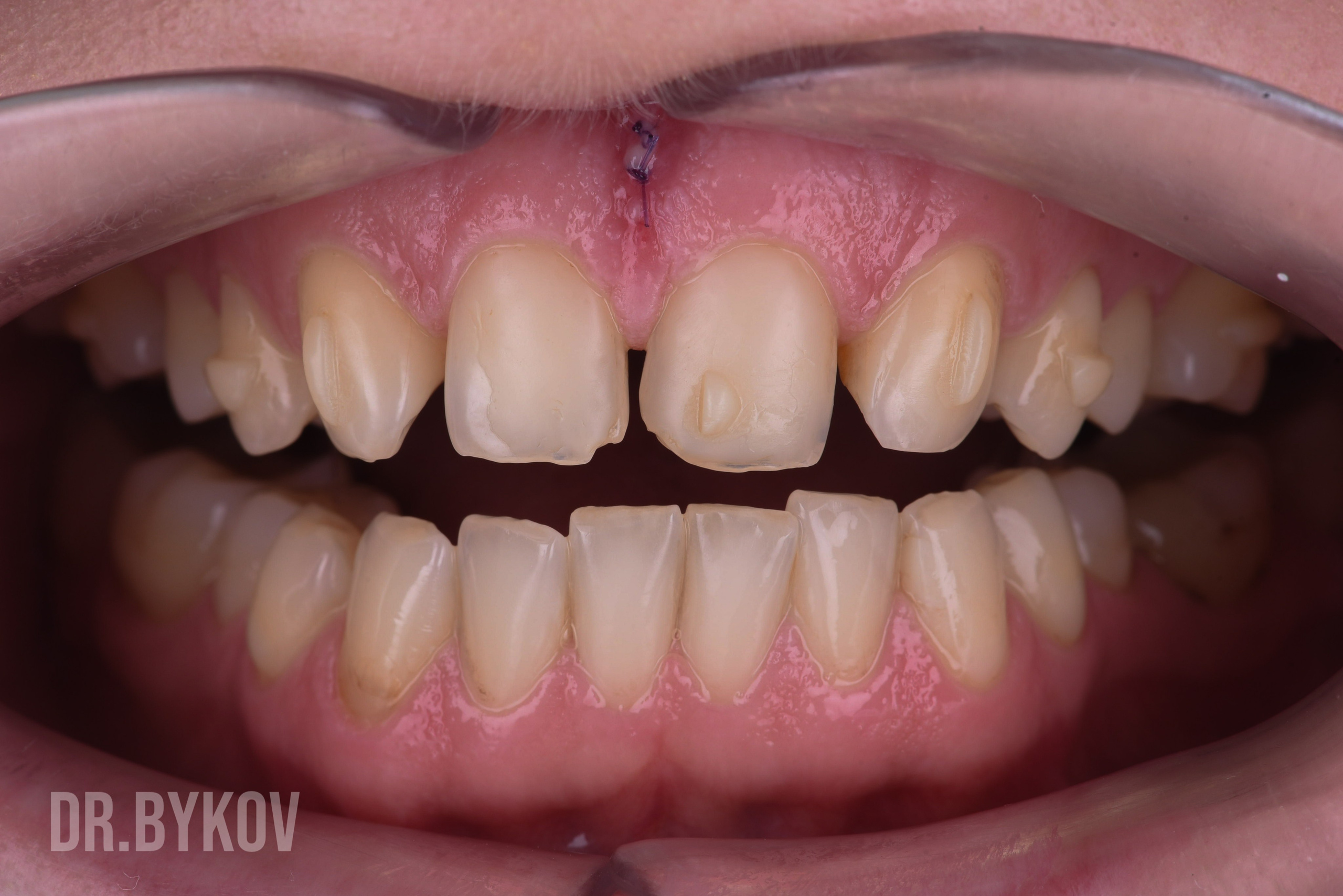 Портфолио. Врач стоматолог-ортопед Быков Алексей