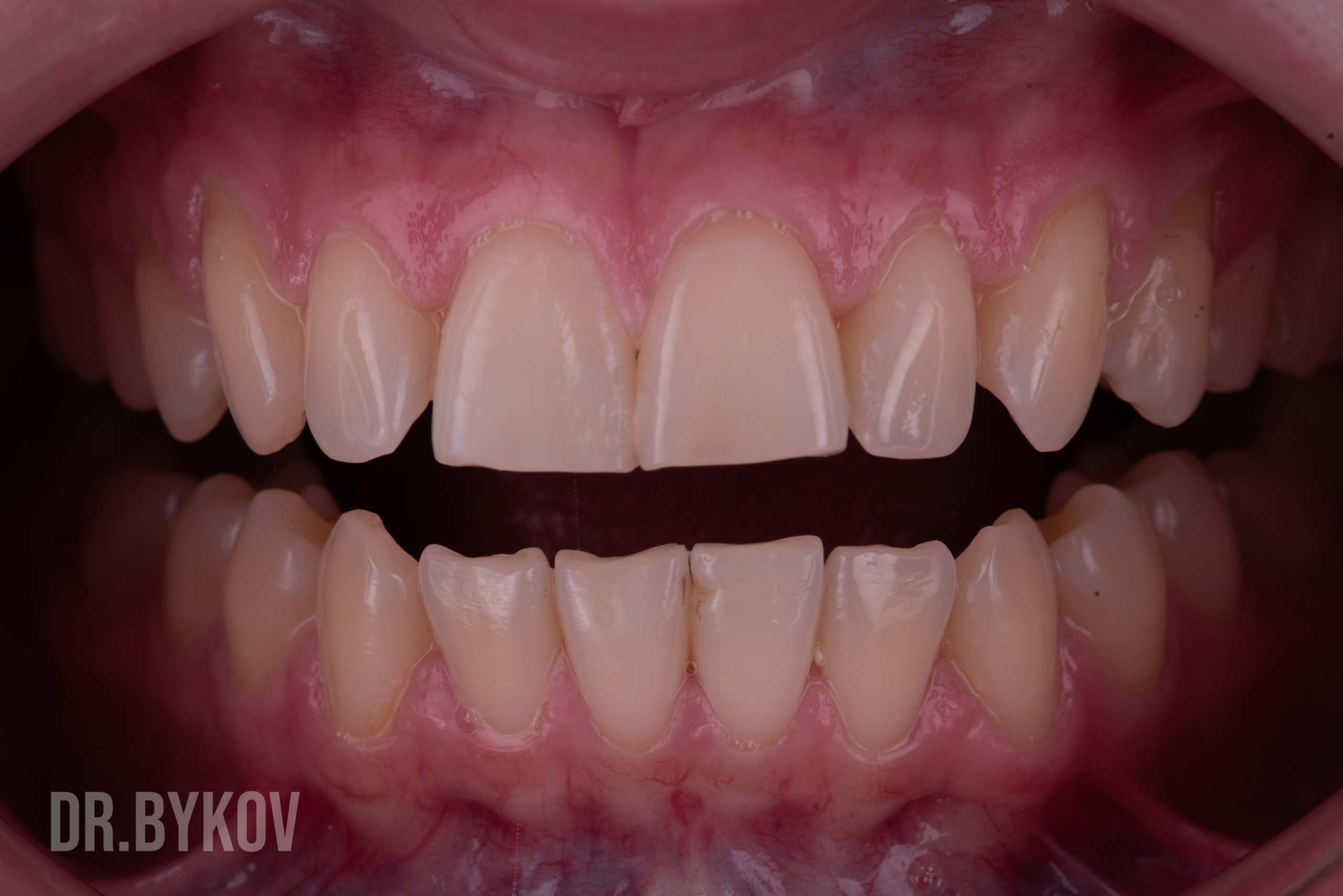 Портфолио. Врач стоматолог-ортопед Быков Алексей