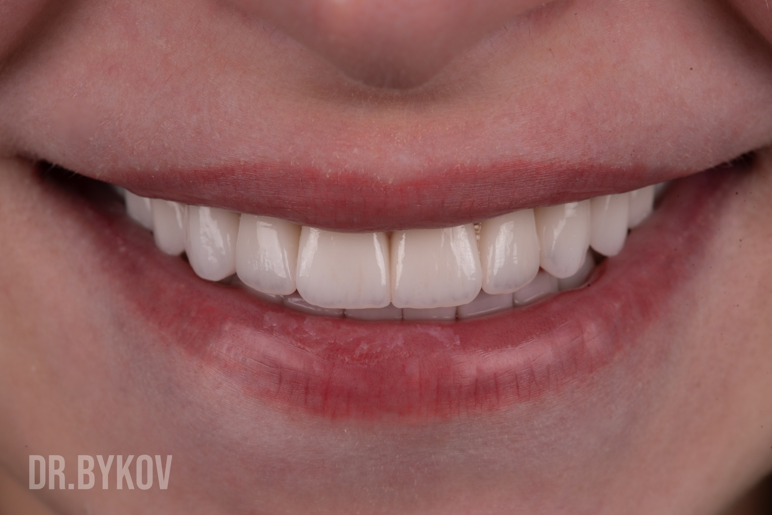 Портфолио. Врач стоматолог-ортопед Быков Алексей