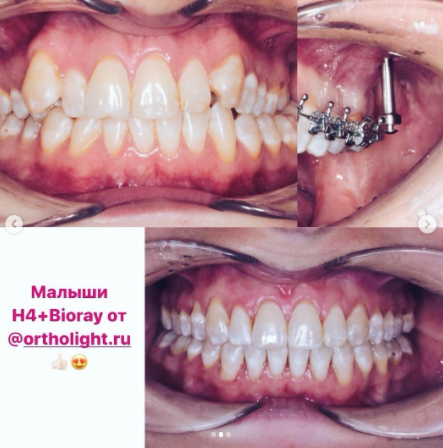 Стоматология в Твери - Линия Улыбки Отзывы. Стоматология в Твери - Линия Улыбки