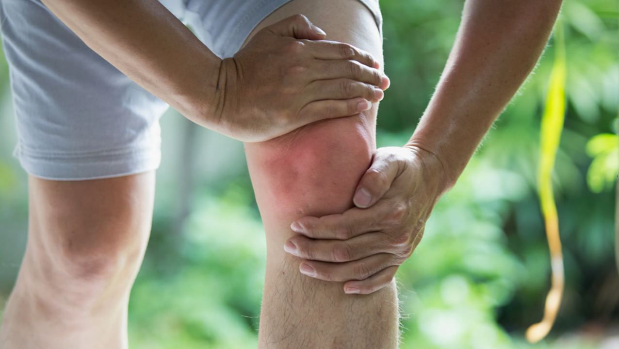 Лечение артроза,  артрита, бурситов остеохандроза при помощи препаратов компании Сово-Сова. Болезни суставов артрит, артроз, остеохандроз, остеоартрит, остеоартроз, бурсит, переломы, вывихи, растяжения чем лечить  компания Сово-Сова