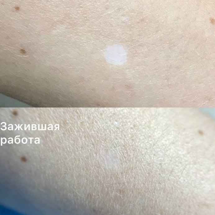 Элла. Студия перманентного макияжа, косметологии и массажа SYMMETRY в Москве, м. Киевская