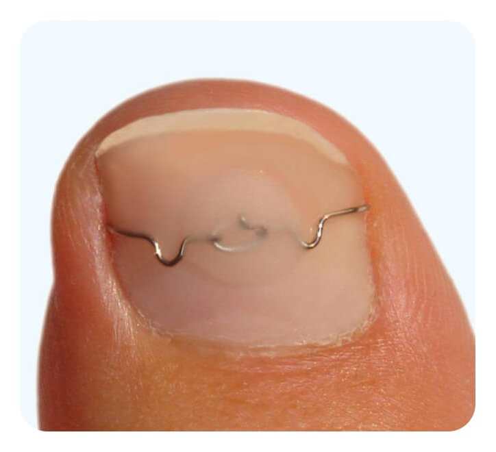 Услуги и цены подолога в Хабаровске, цены на педикюр Хабаровск. Подолог г. Хабаровск — центр здоровой стопы «FOOTTIME»