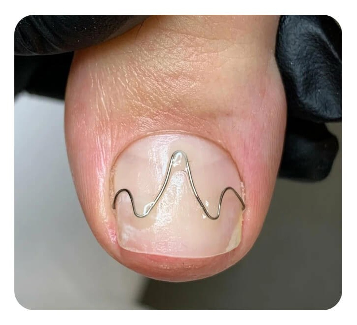 Услуги и цены подолога в Хабаровске, цены на педикюр Хабаровск. Подолог г. Хабаровск — центр здоровой стопы «FOOTTIME»