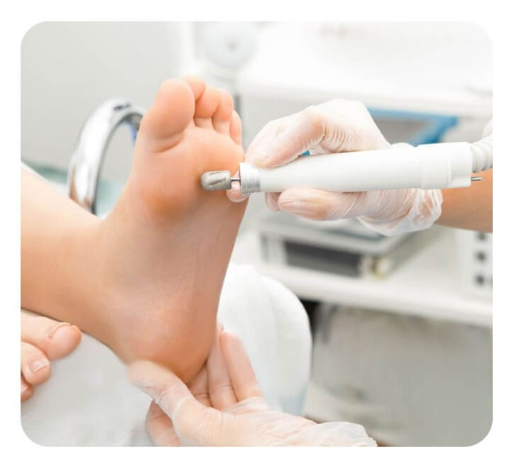 Медицинский педикюр