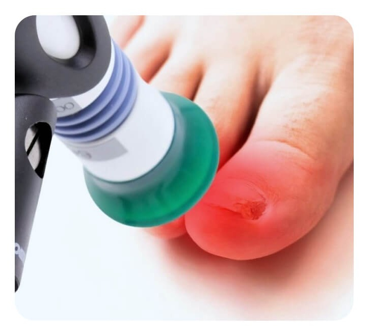 Услуги и цены подолога в Хабаровске, цены на педикюр Хабаровск. Подолог г. Хабаровск — центр здоровой стопы «FOOTTIME»