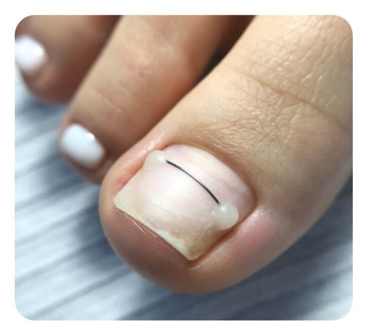 Услуги и цены подолога в Хабаровске, цены на педикюр Хабаровск. Подолог г. Хабаровск — центр здоровой стопы «FOOTTIME»