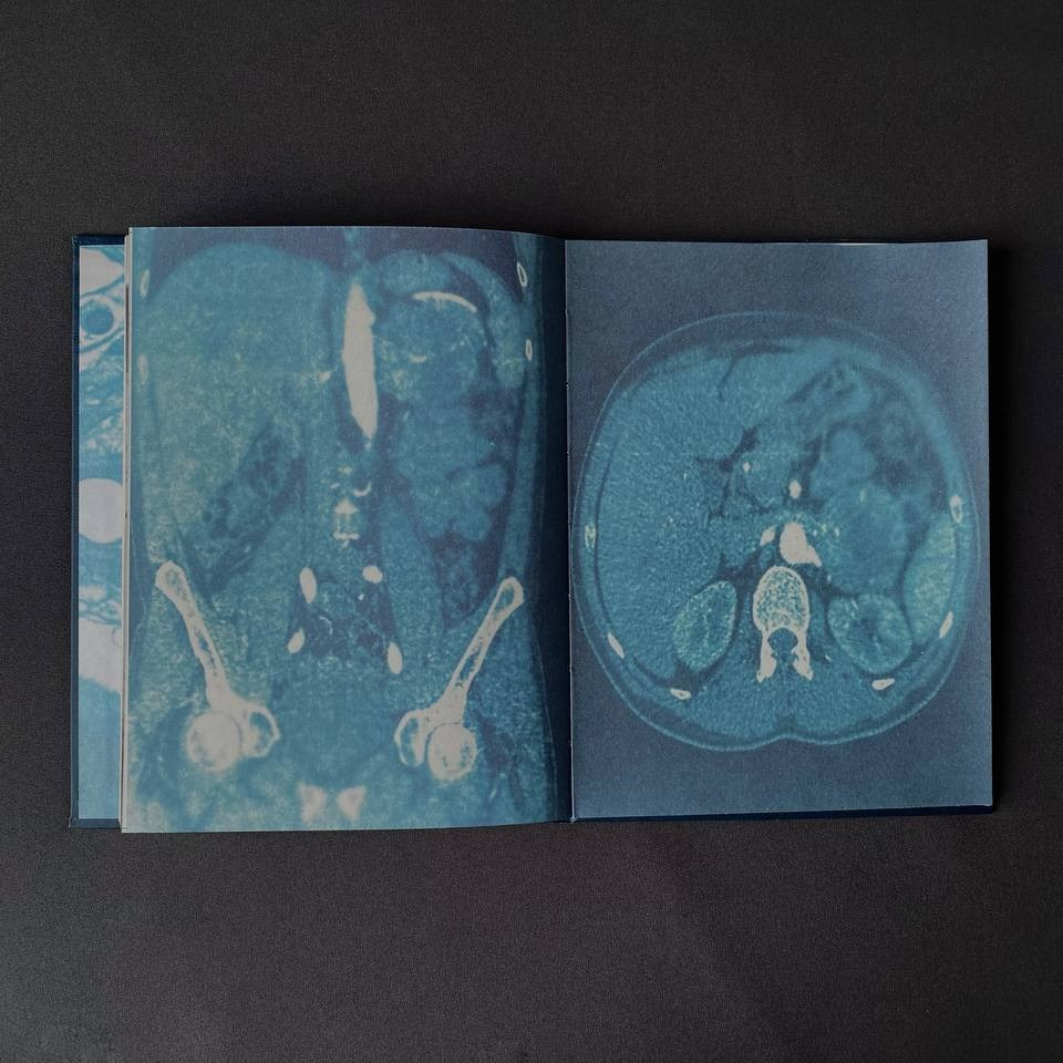 Индивидуальные консультации. Самоорганизация Низина