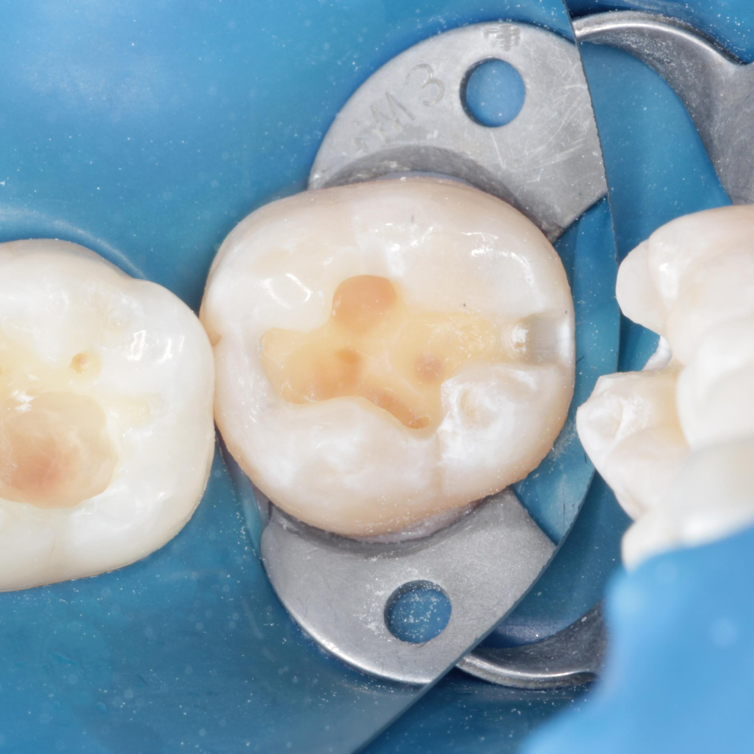 Стоматология в Твери - Линия Улыбки Услуги и цены. Стоматология в Твери - Линия Улыбки